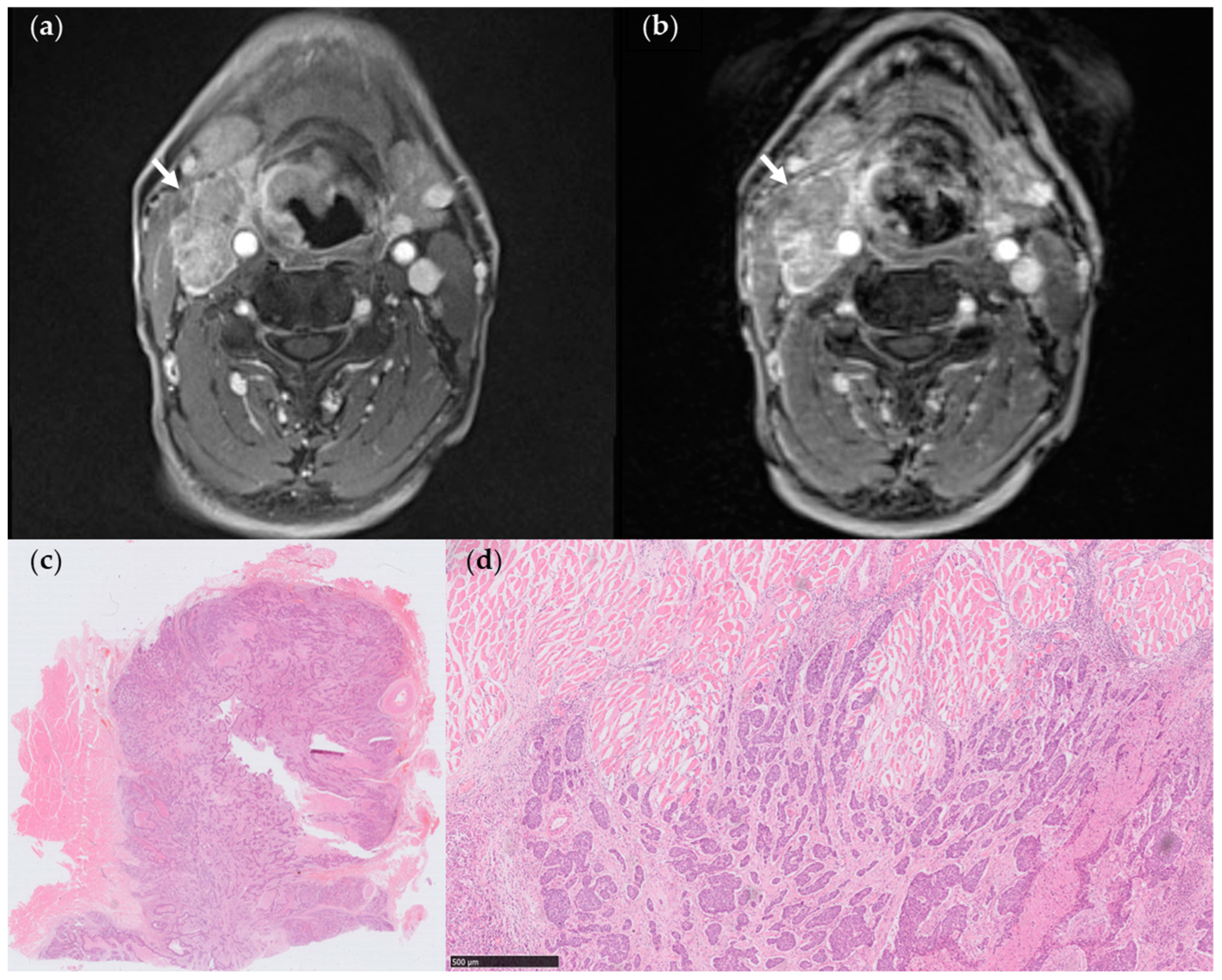 Cancers 15 04992 g003