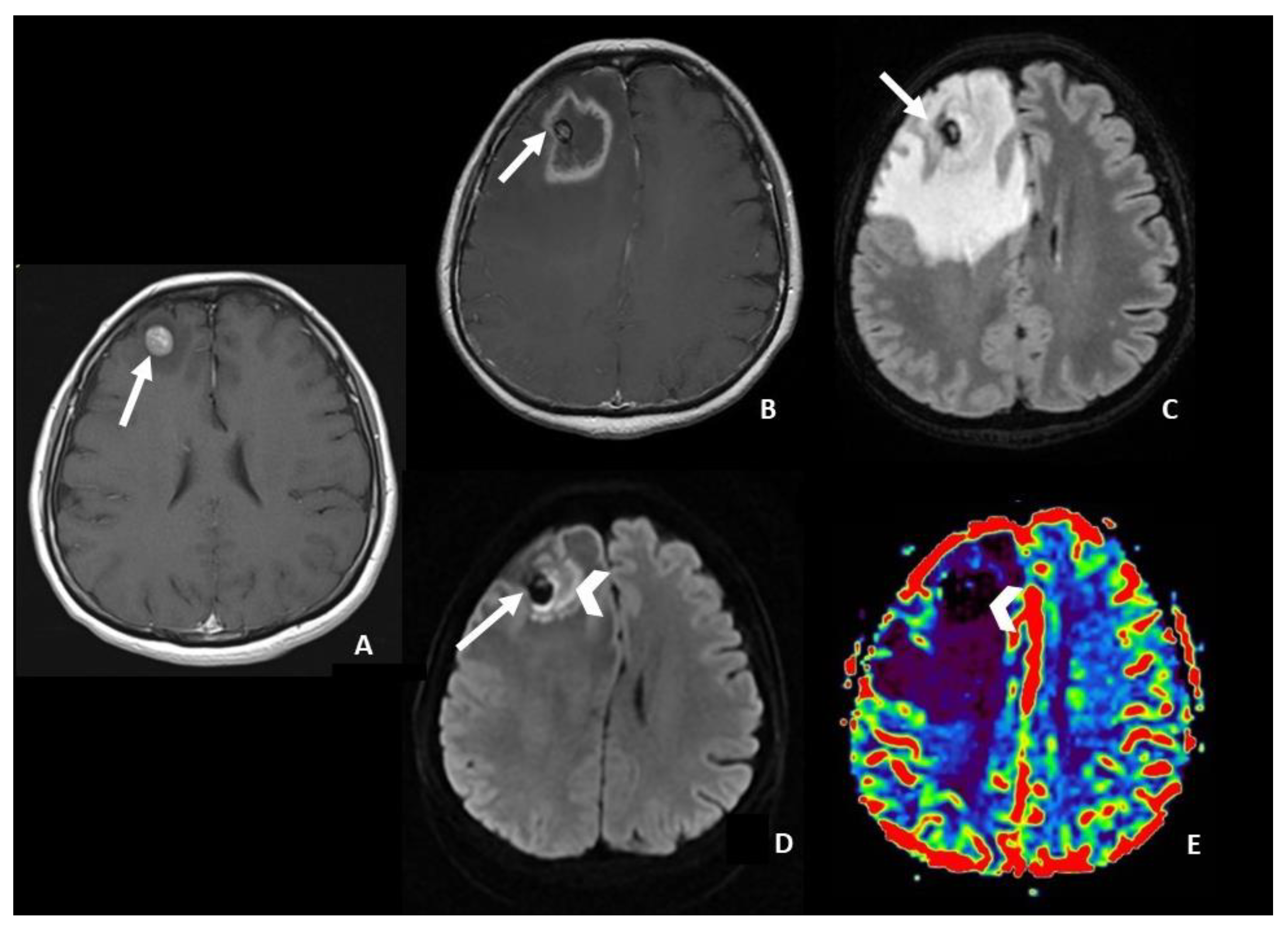 Cancers 15 05092 g001