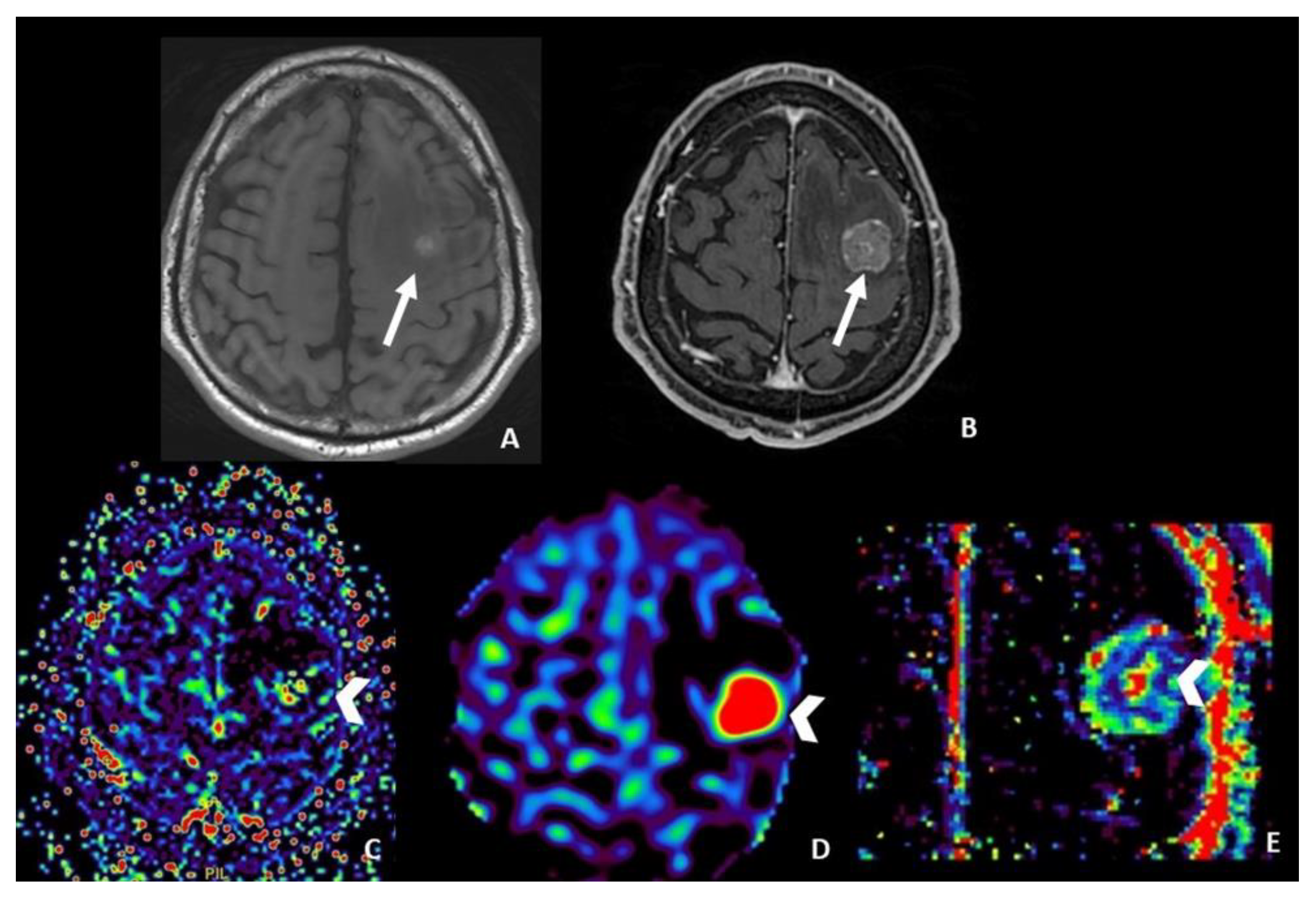 Cancers 15 05092 g002