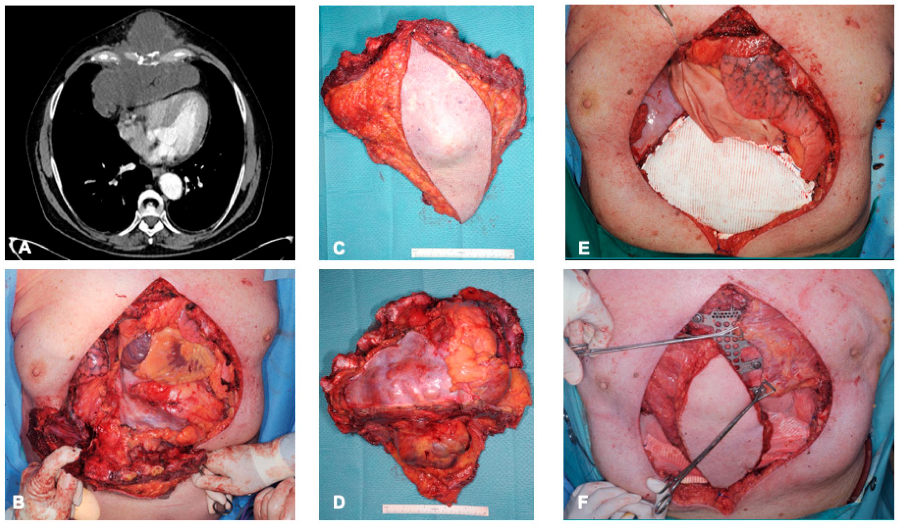 Cancers 15 05154 g002