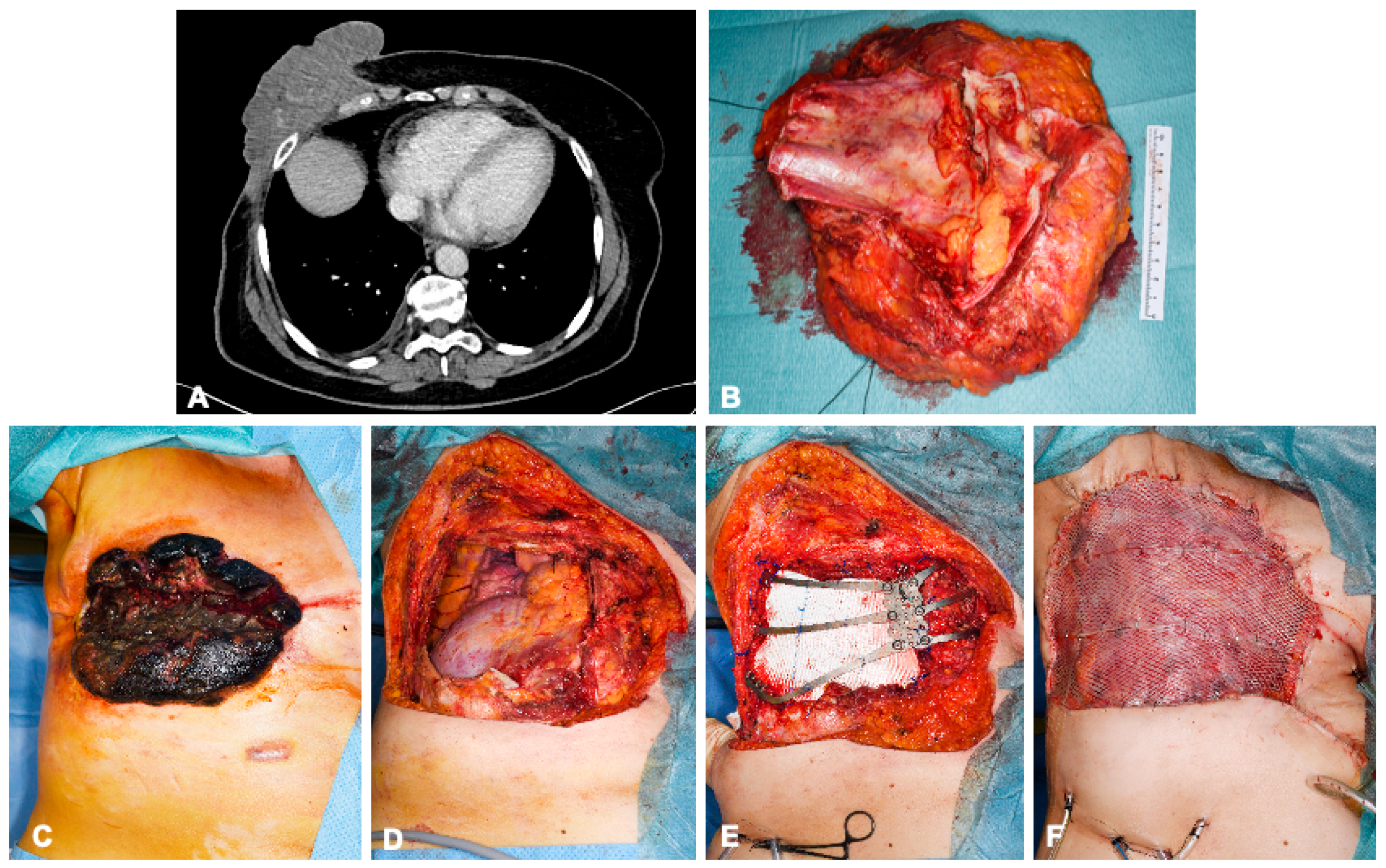Cancers 15 05154 g003