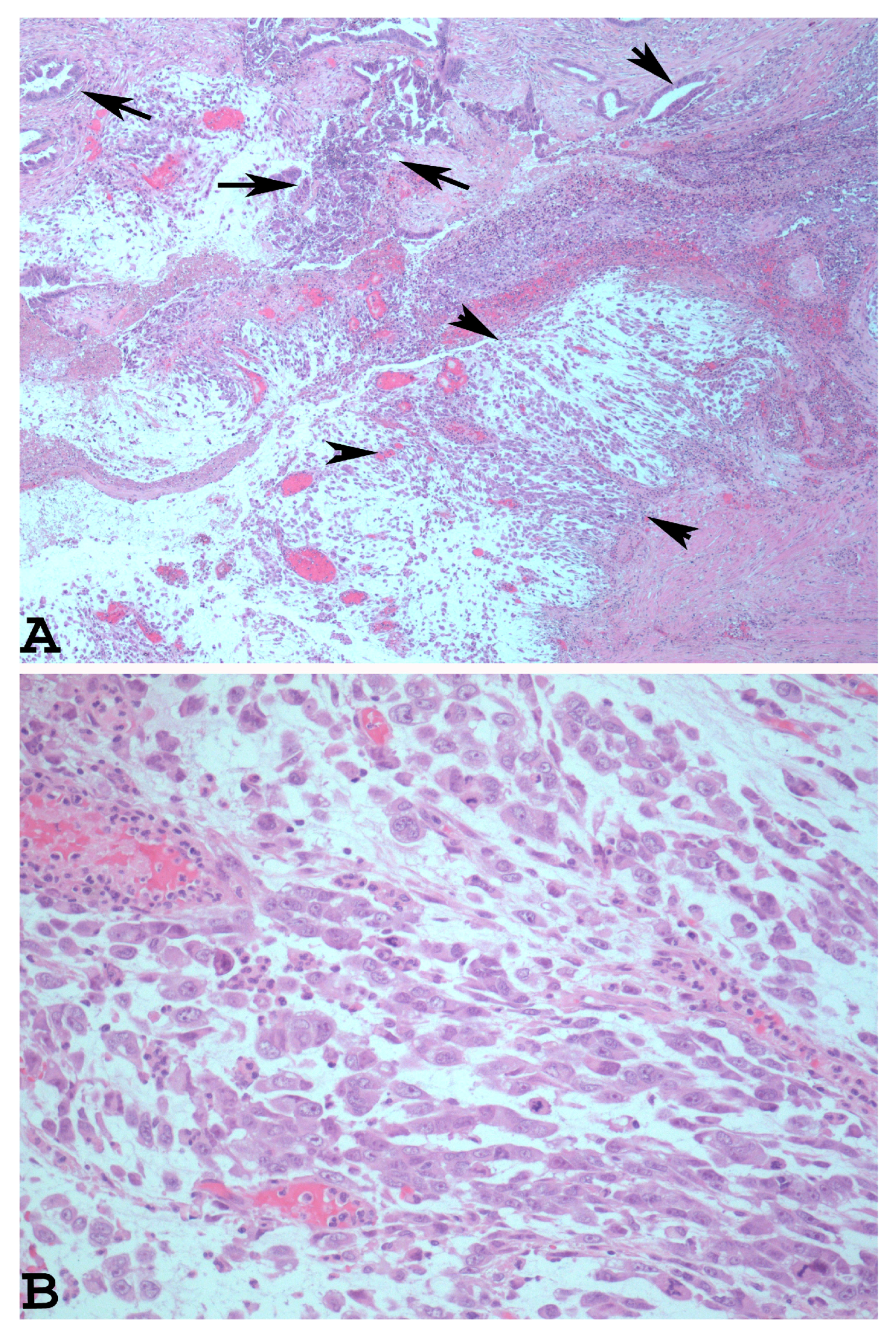 Cancers 15 05155 g002