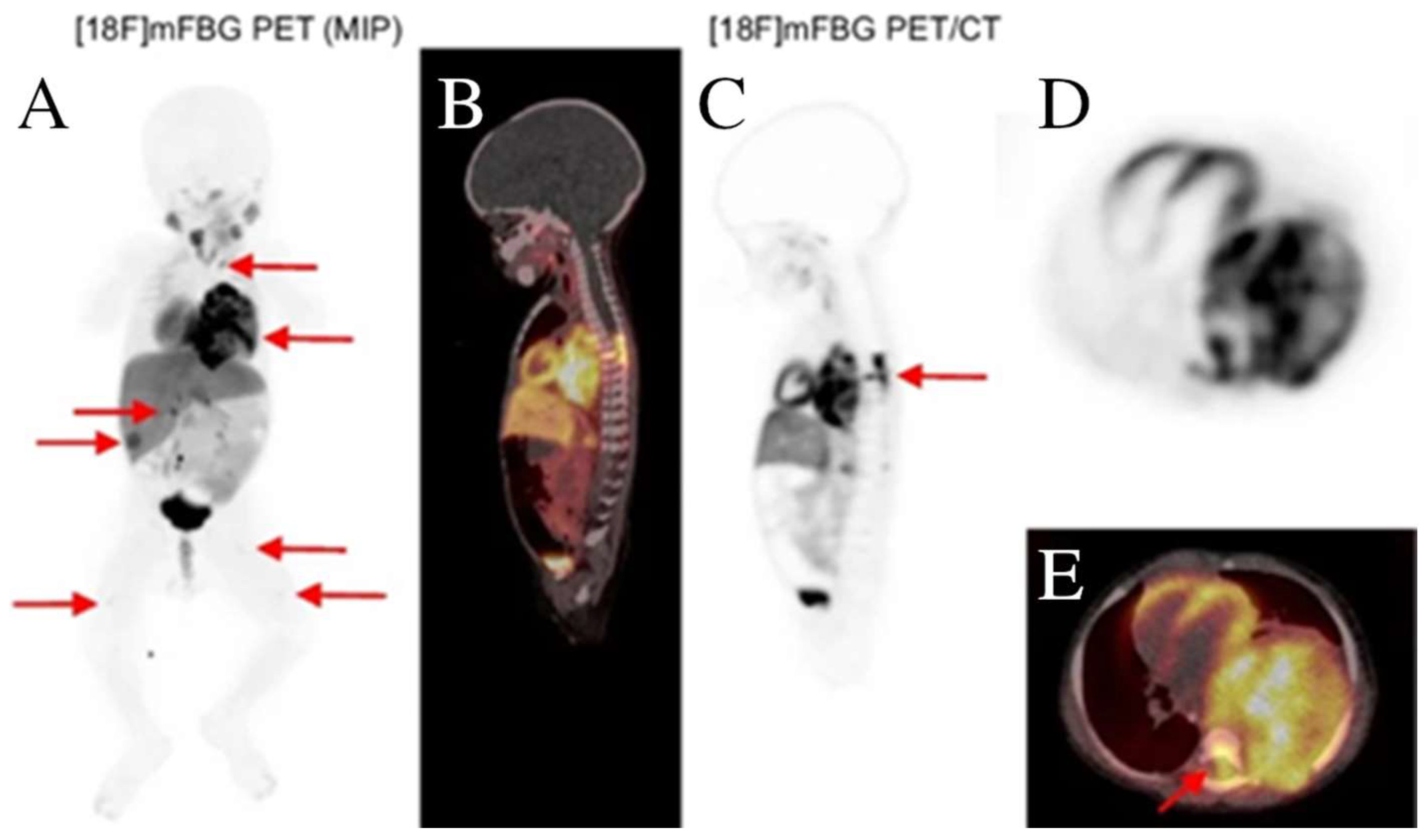 Cancers 15 05173 g004 Cancers 15 05173 g004