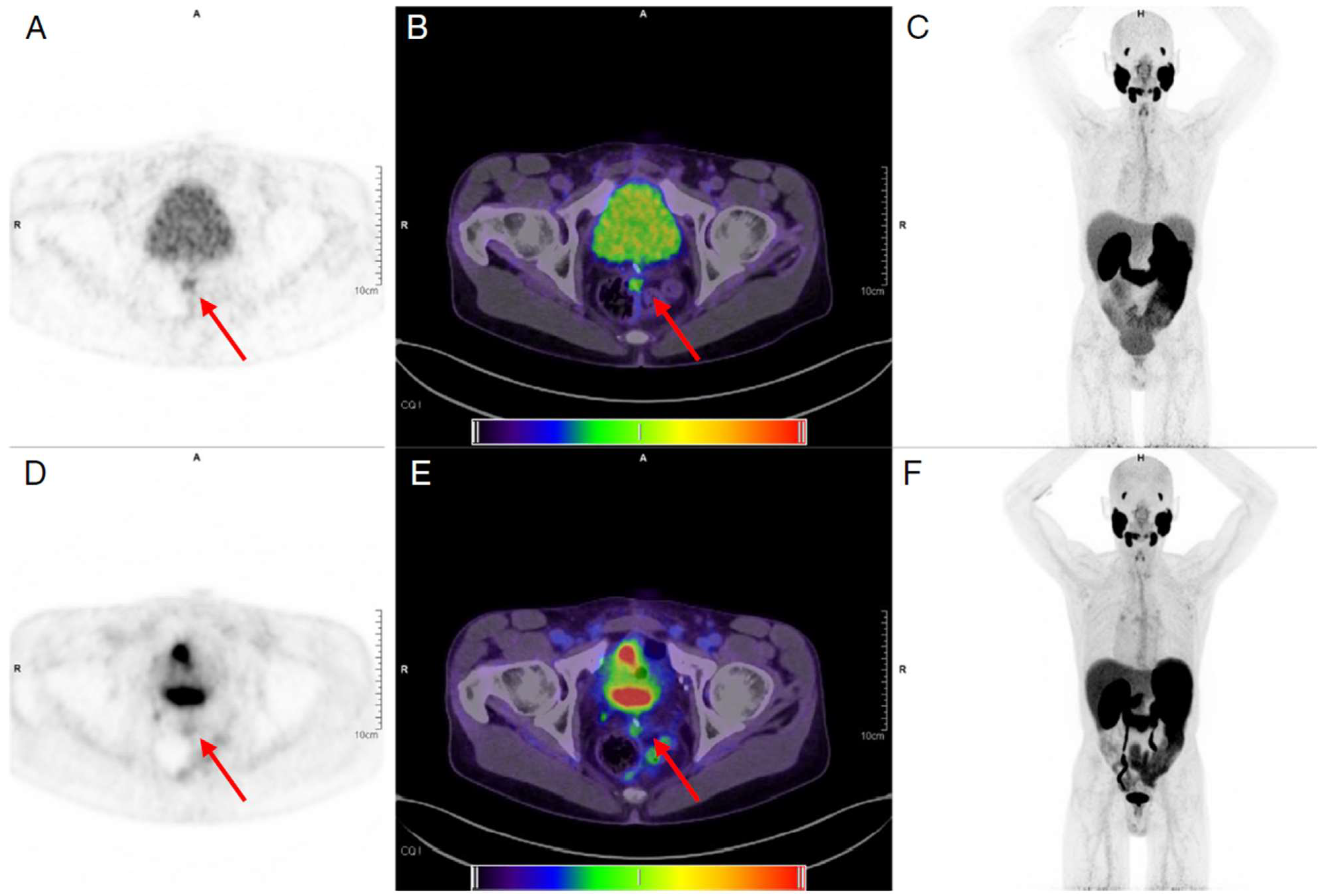 Cancers 15 05173 g010 Cancers 15 05173 g010