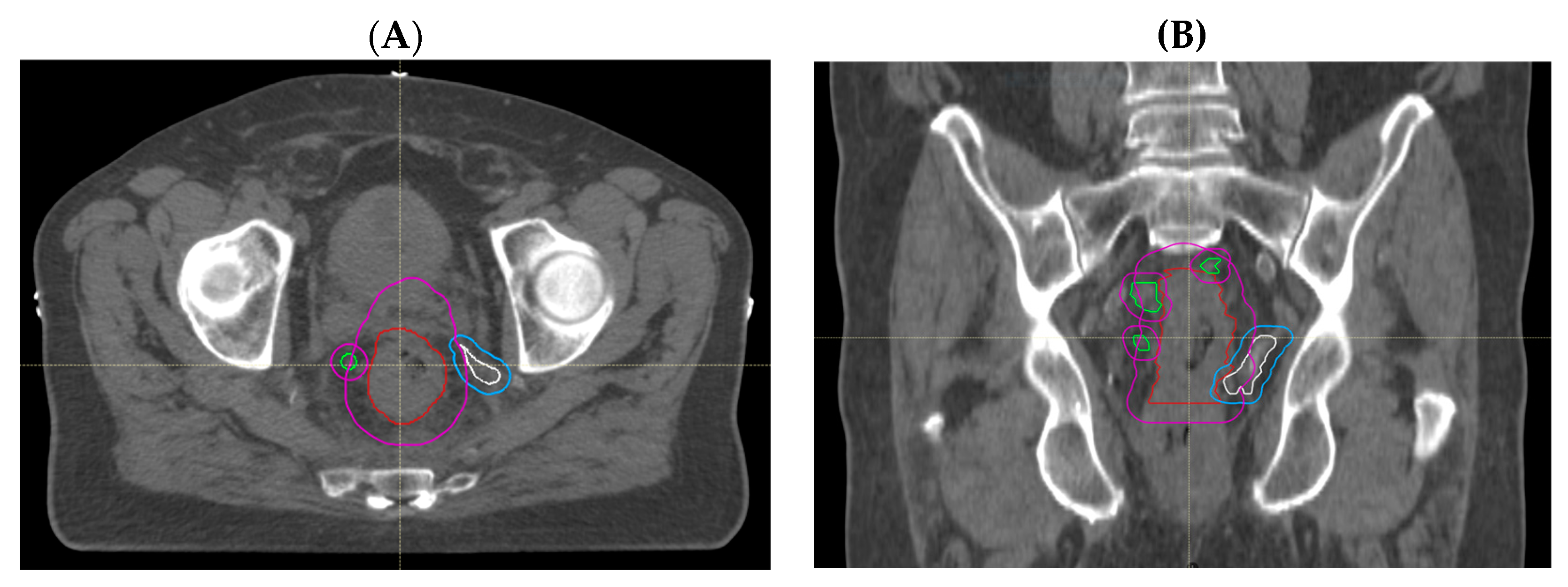 Cancers 15 05176 g003