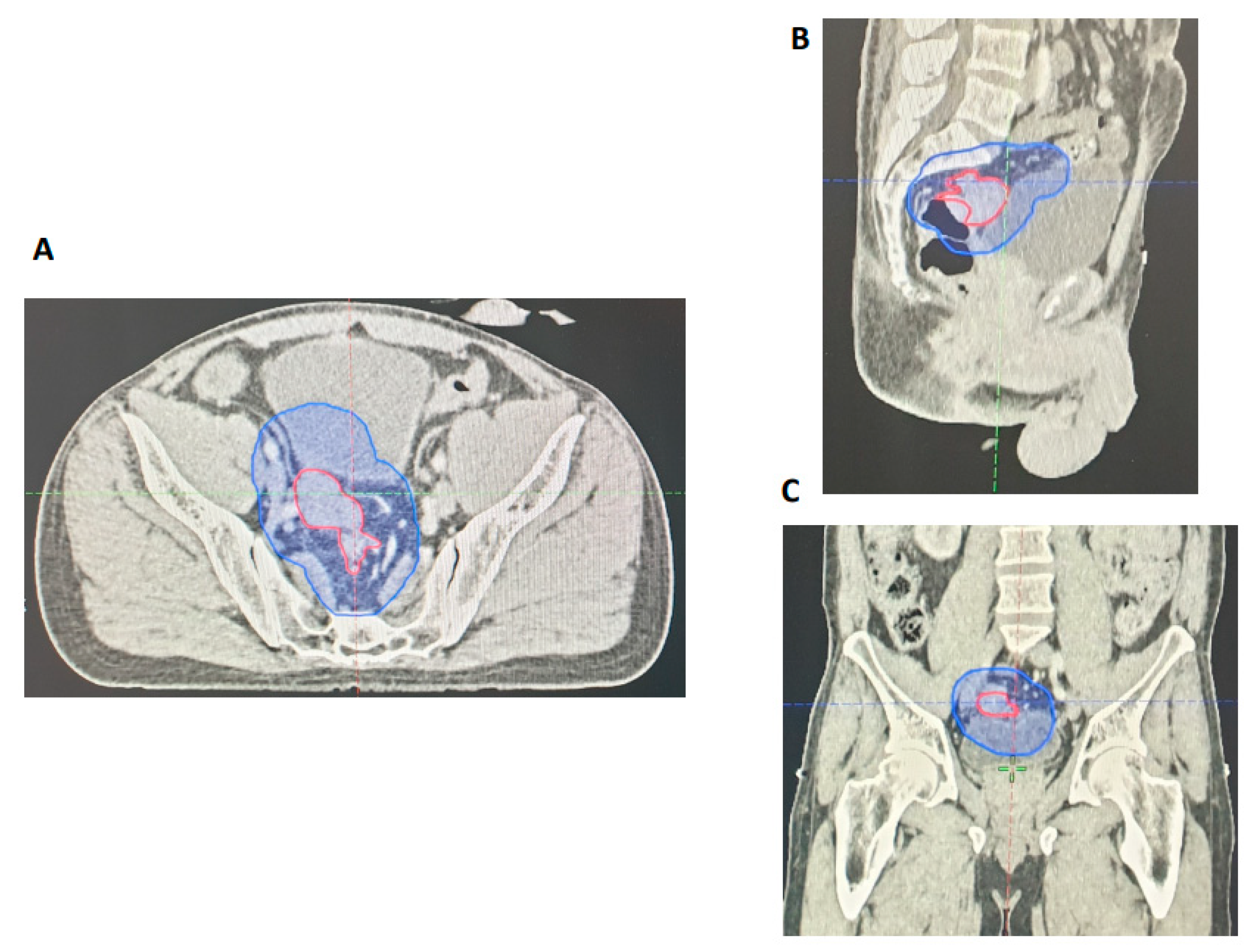 Cancers 15 05176 g004