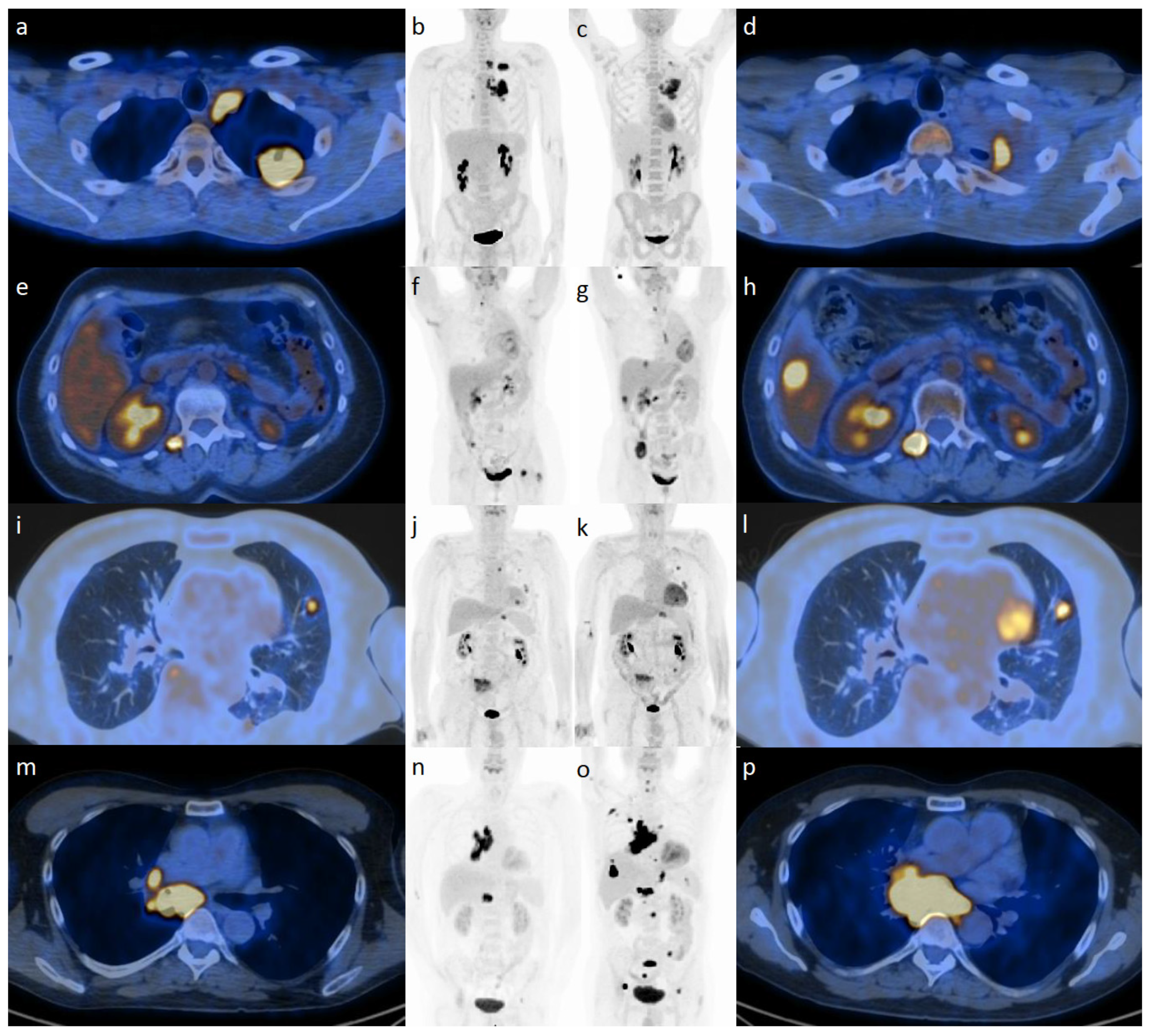 Cancers 15 05179 g002