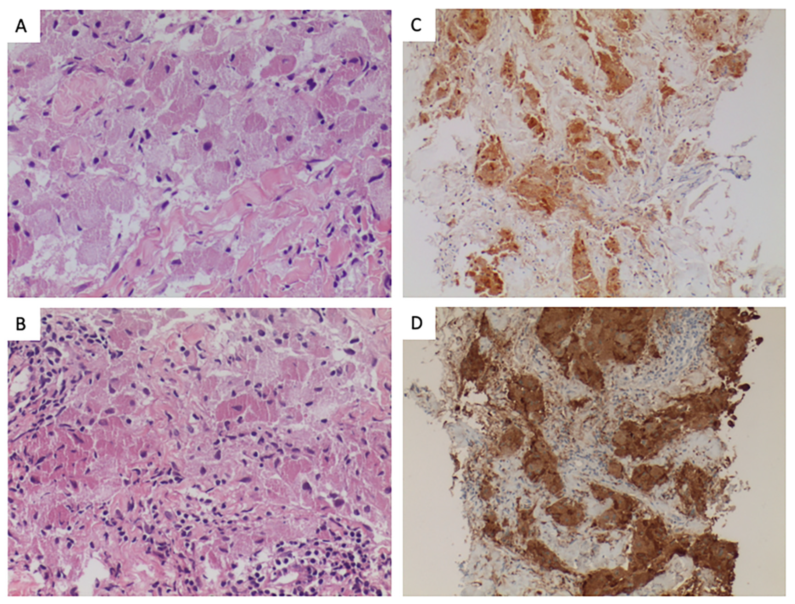 Cancers 15 05187 g001