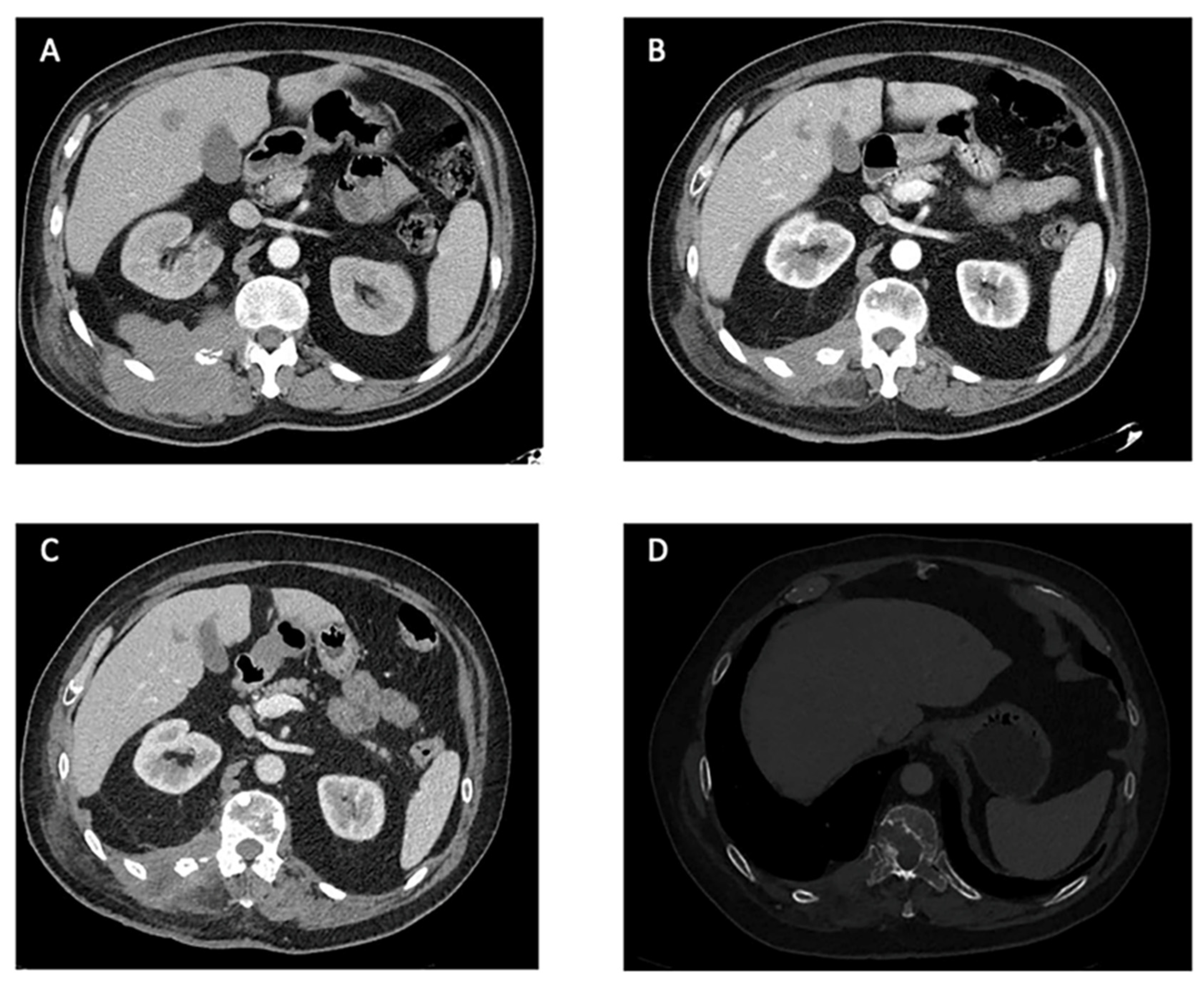 Cancers 15 05187 g003