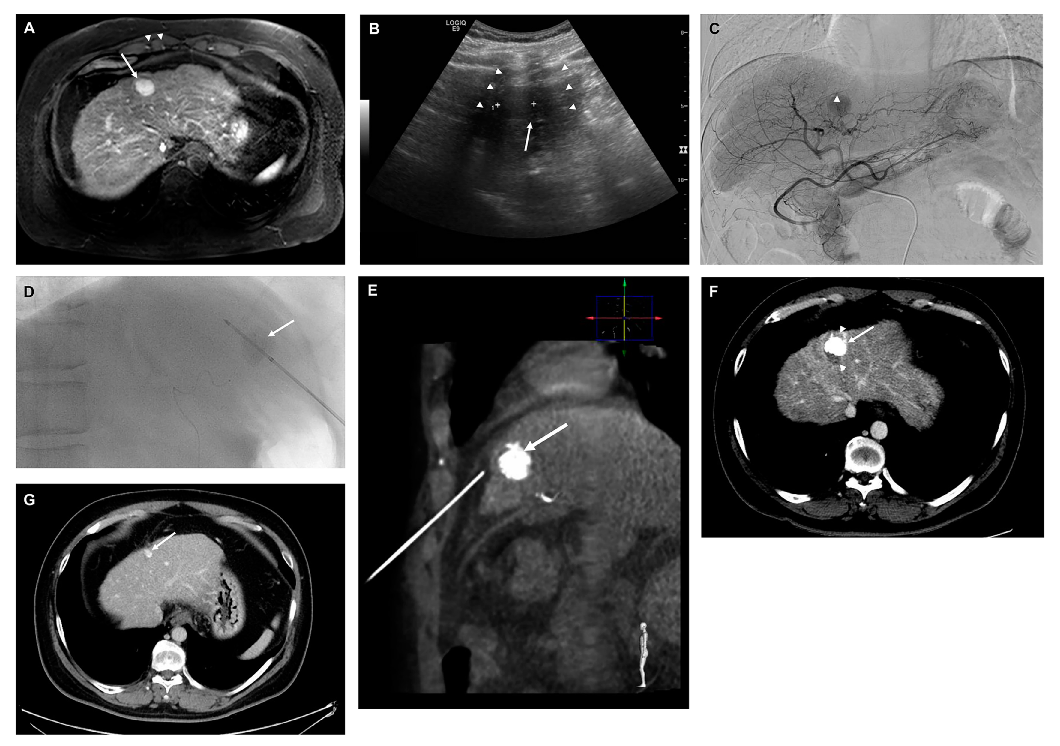 Cancers 15 05193 g005