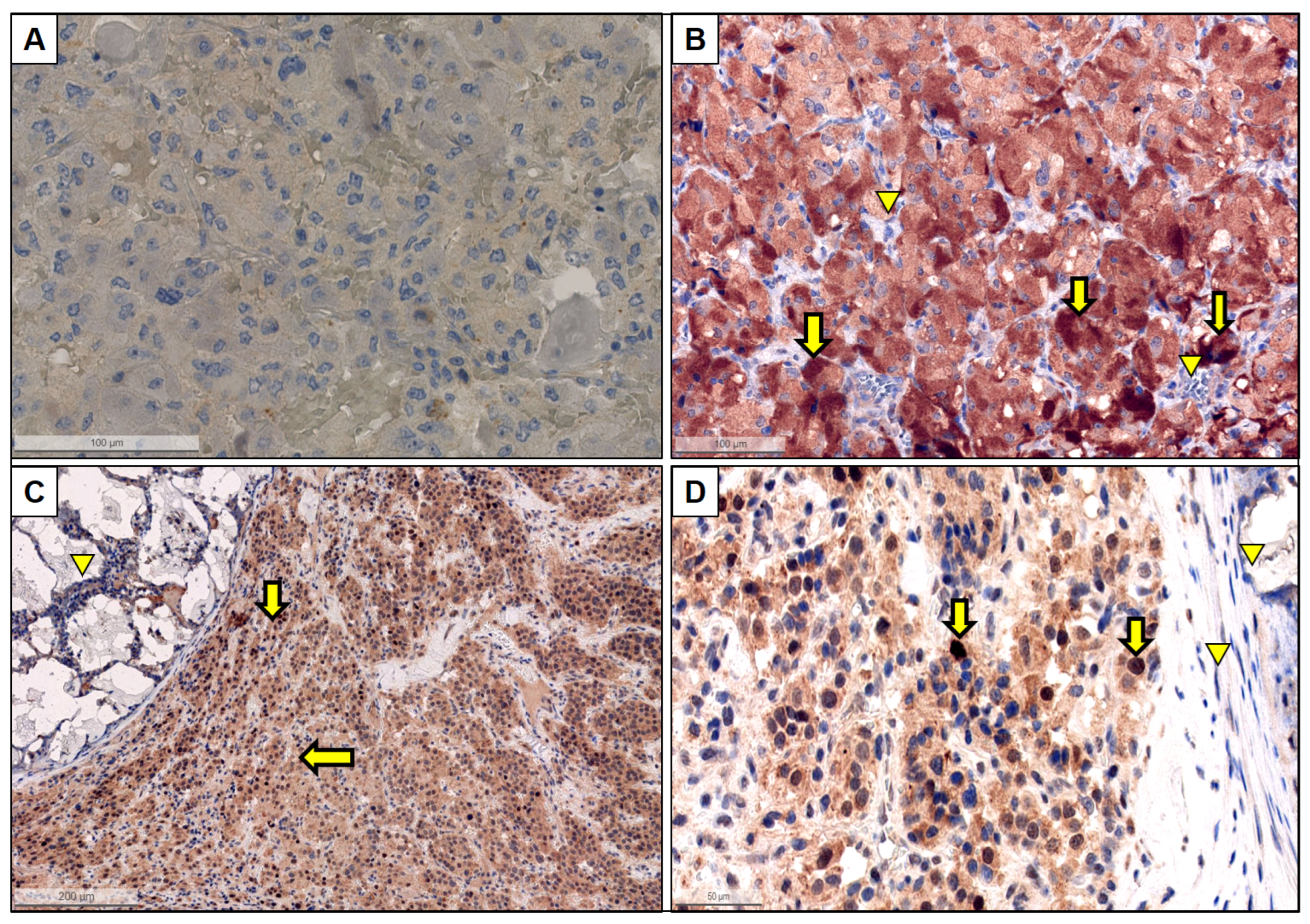 Cancers 15 05199 g003