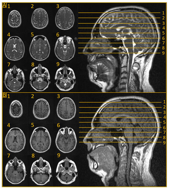 Revolutionizing the Treatment of Brain Disorders - SBU News