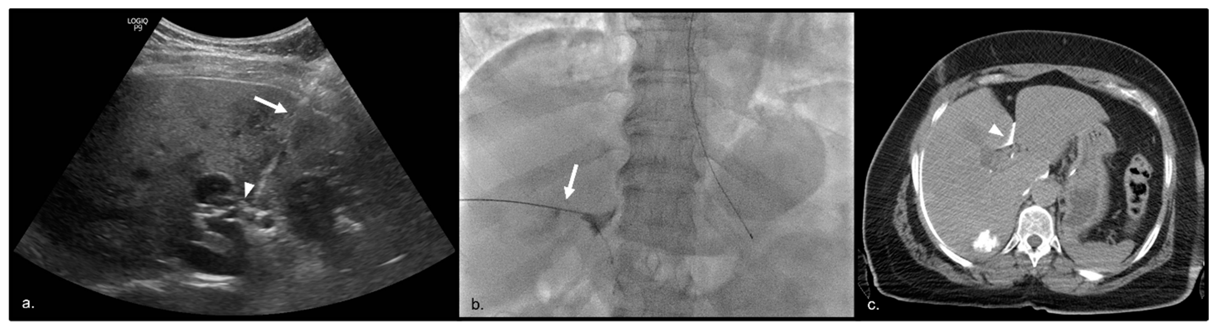 Cancers 15 05202 g001