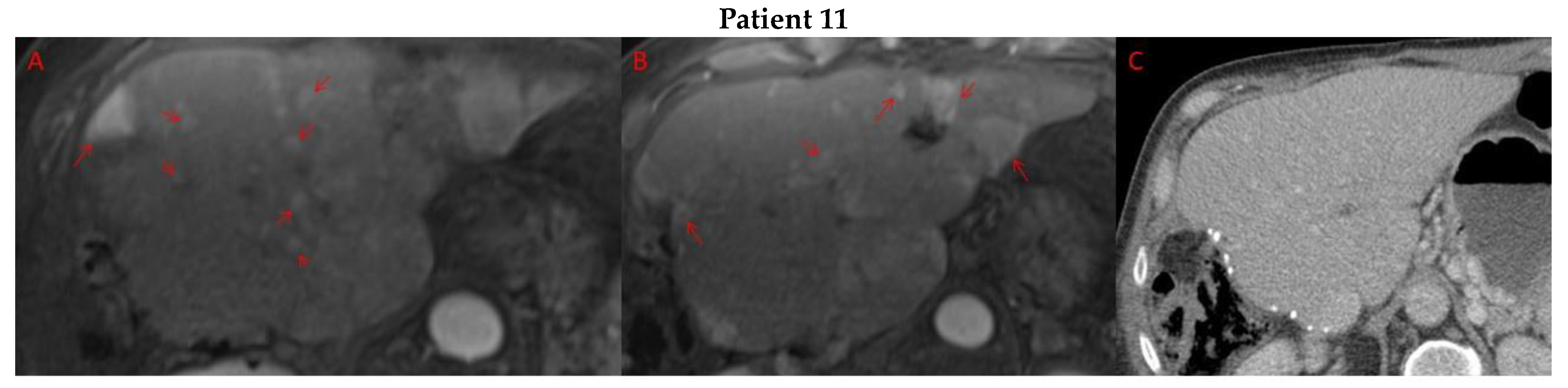 Cancers 15 05220 g003d