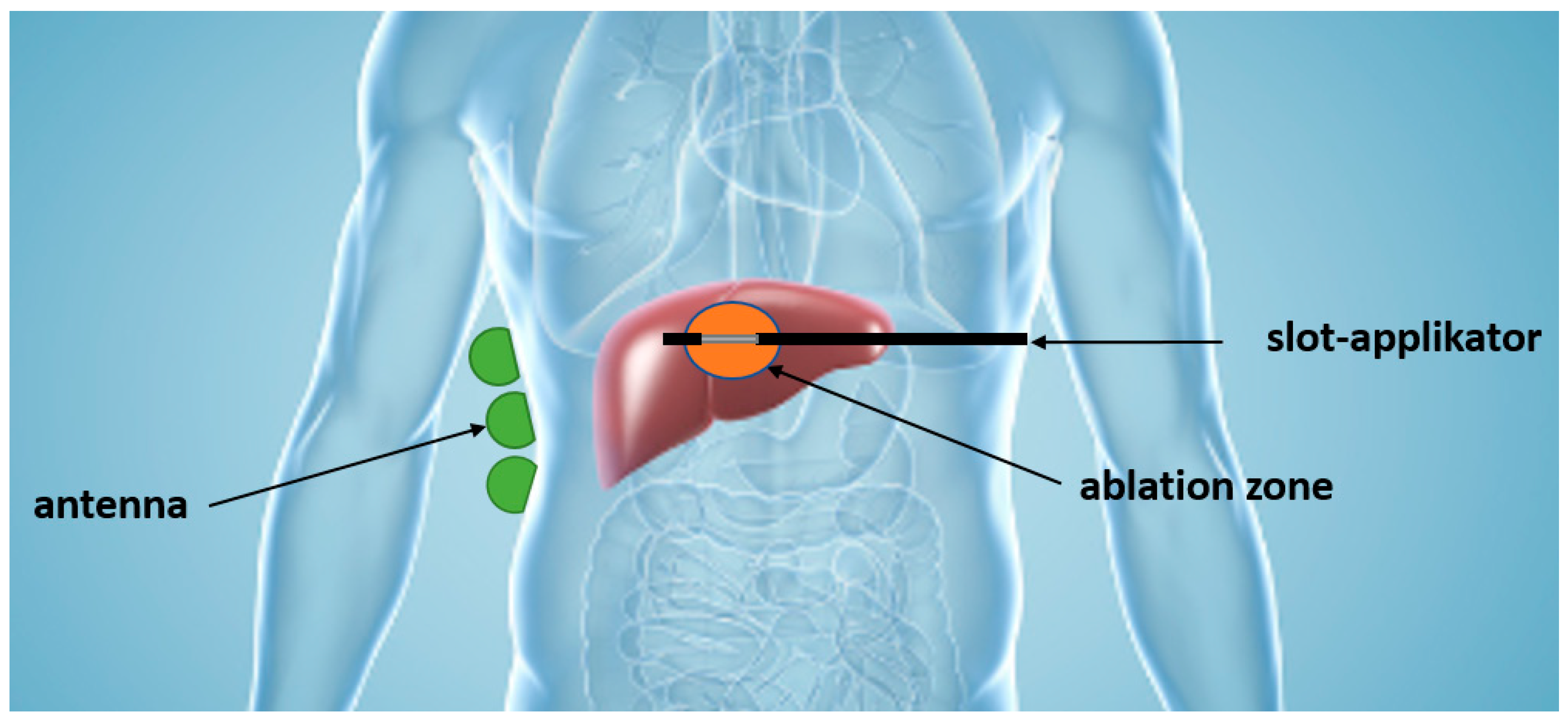 Cancers 15 05230 g001