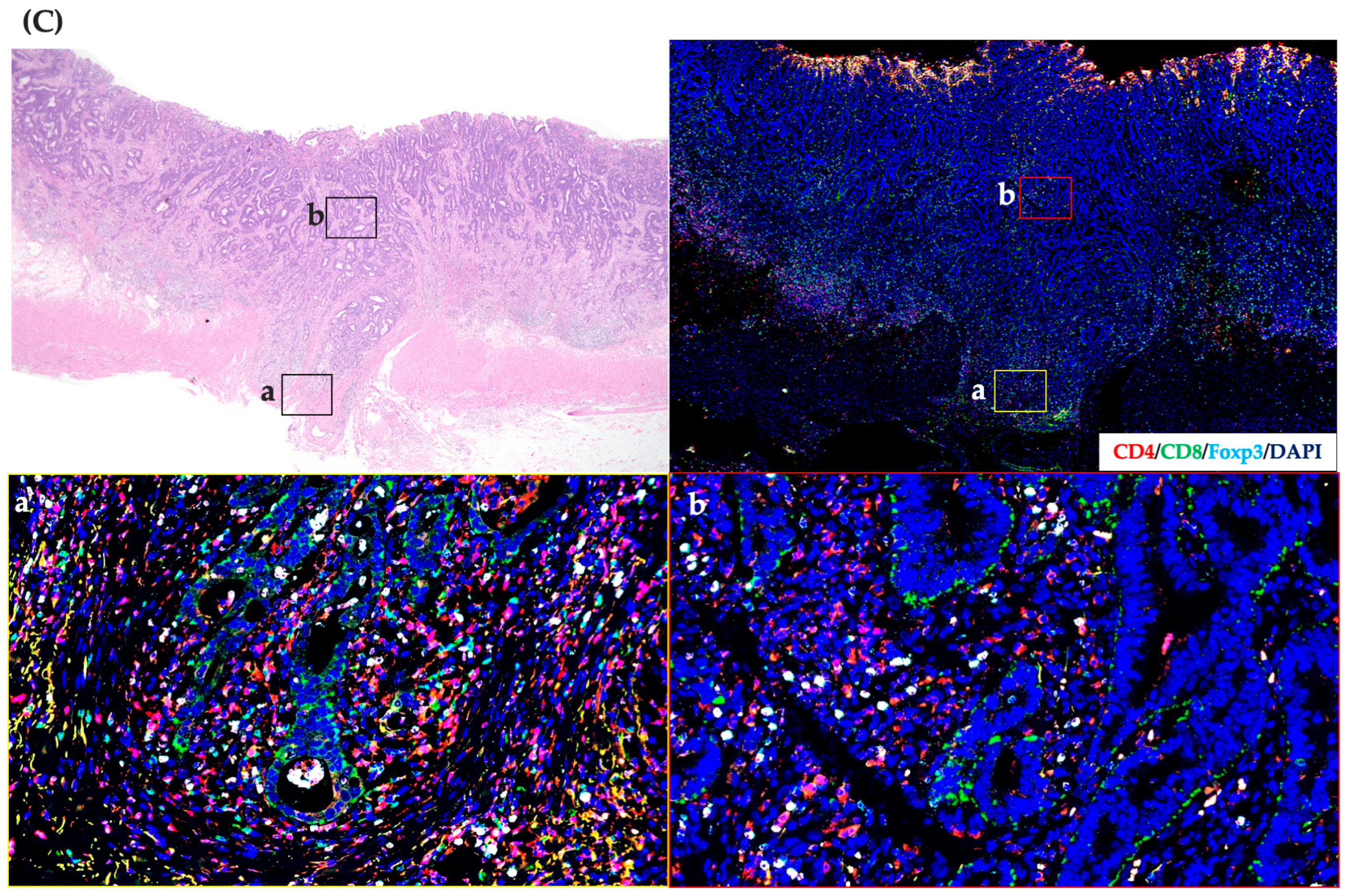 Cancers 15 05238 g002b