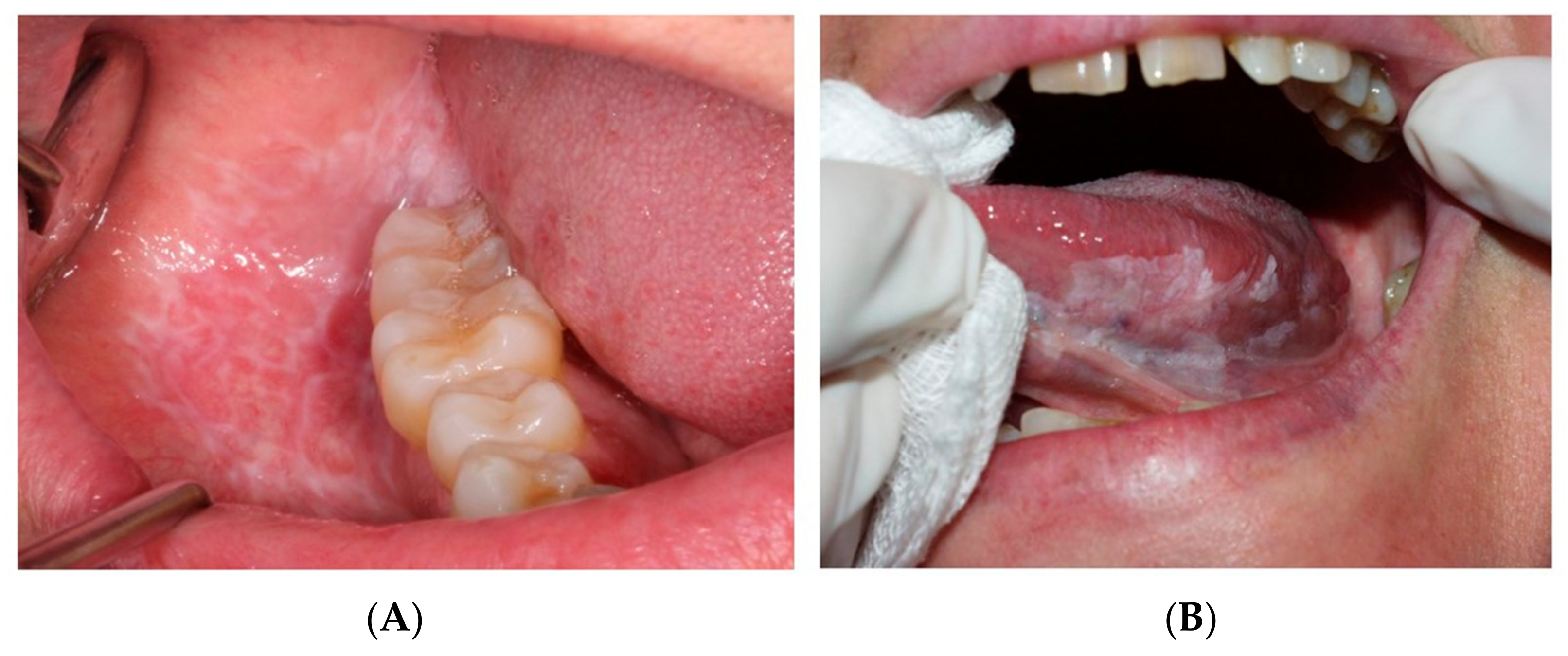 Cancers 15 05256 g002