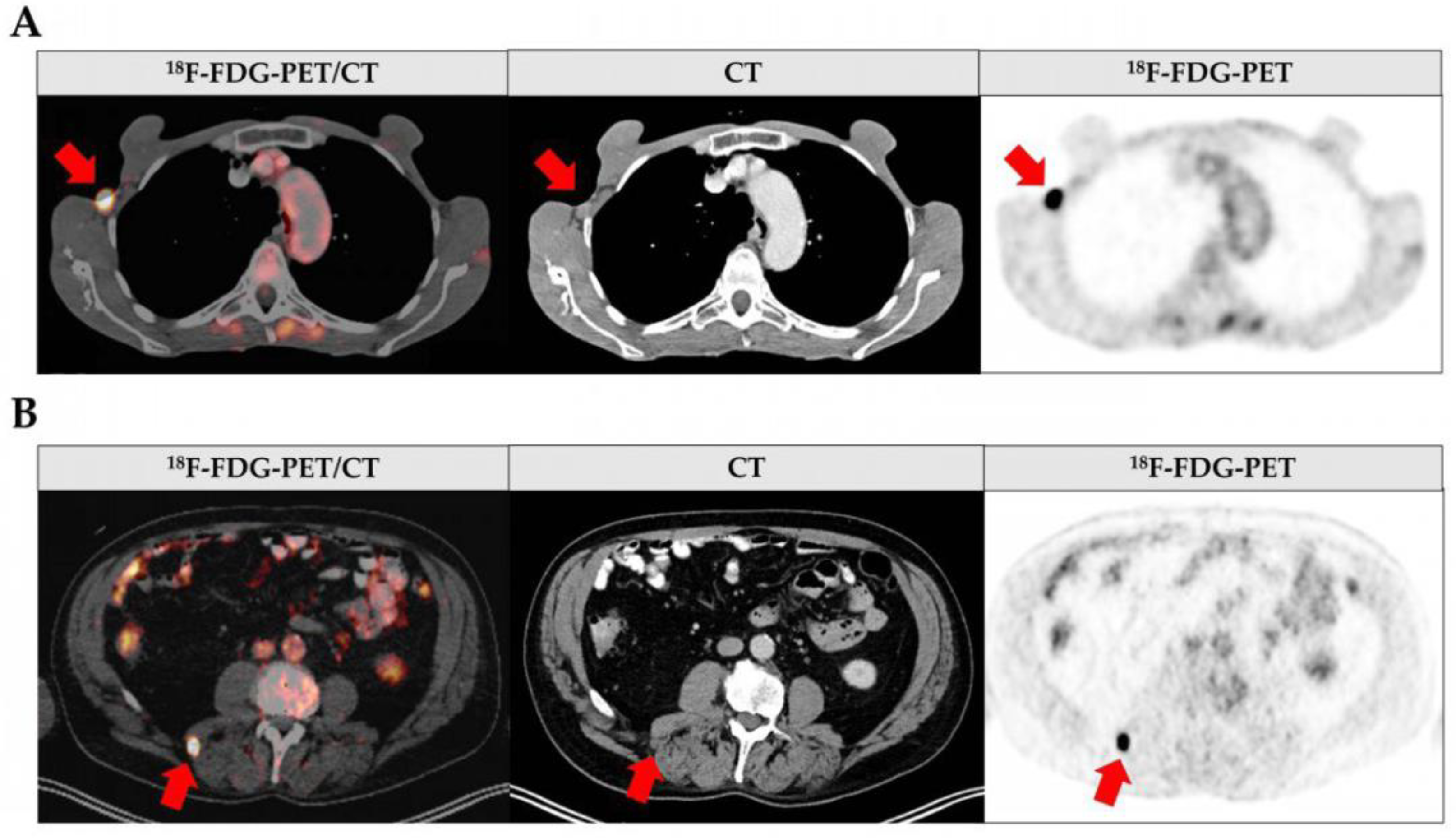 Cancers 15 05265 g003