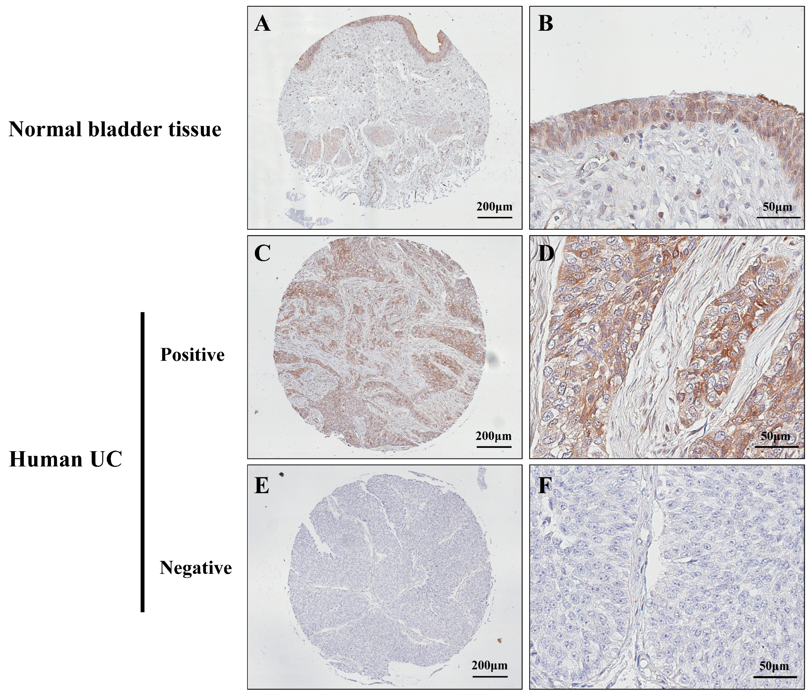 Cancers 15 05274 g004 Cancers 15 05274 g004
