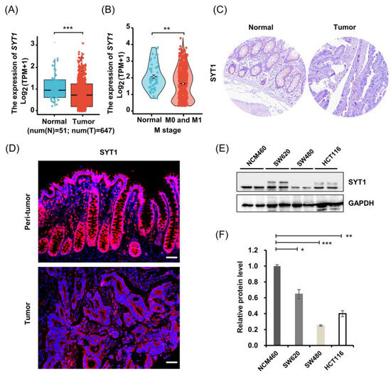 Synaptotagmin 1 Suppresses Colorectal Cancer Metastasis by