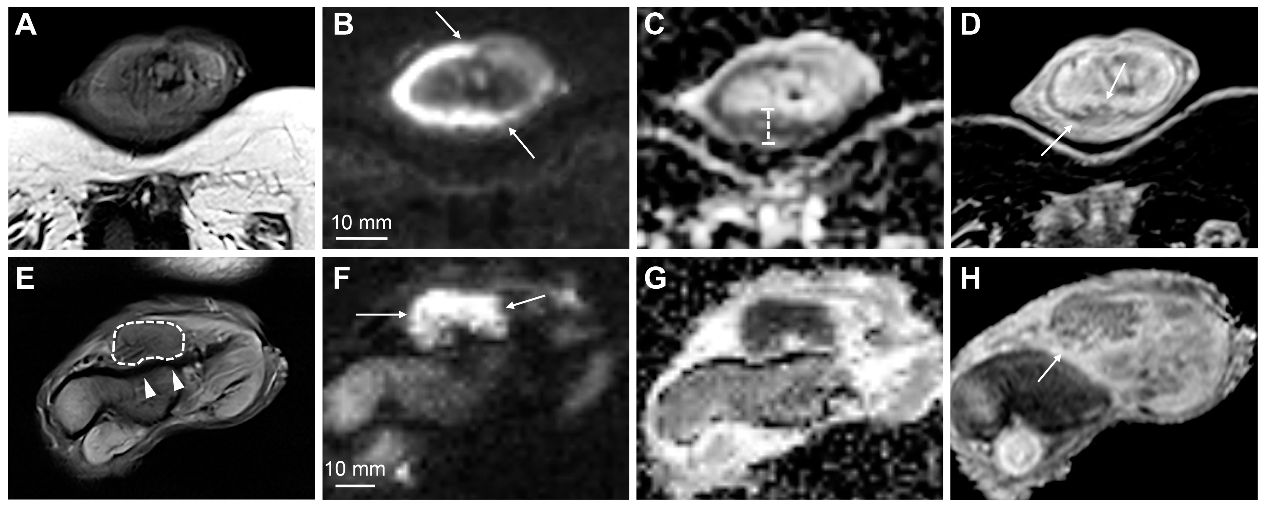 Cancers 15 05324 g003