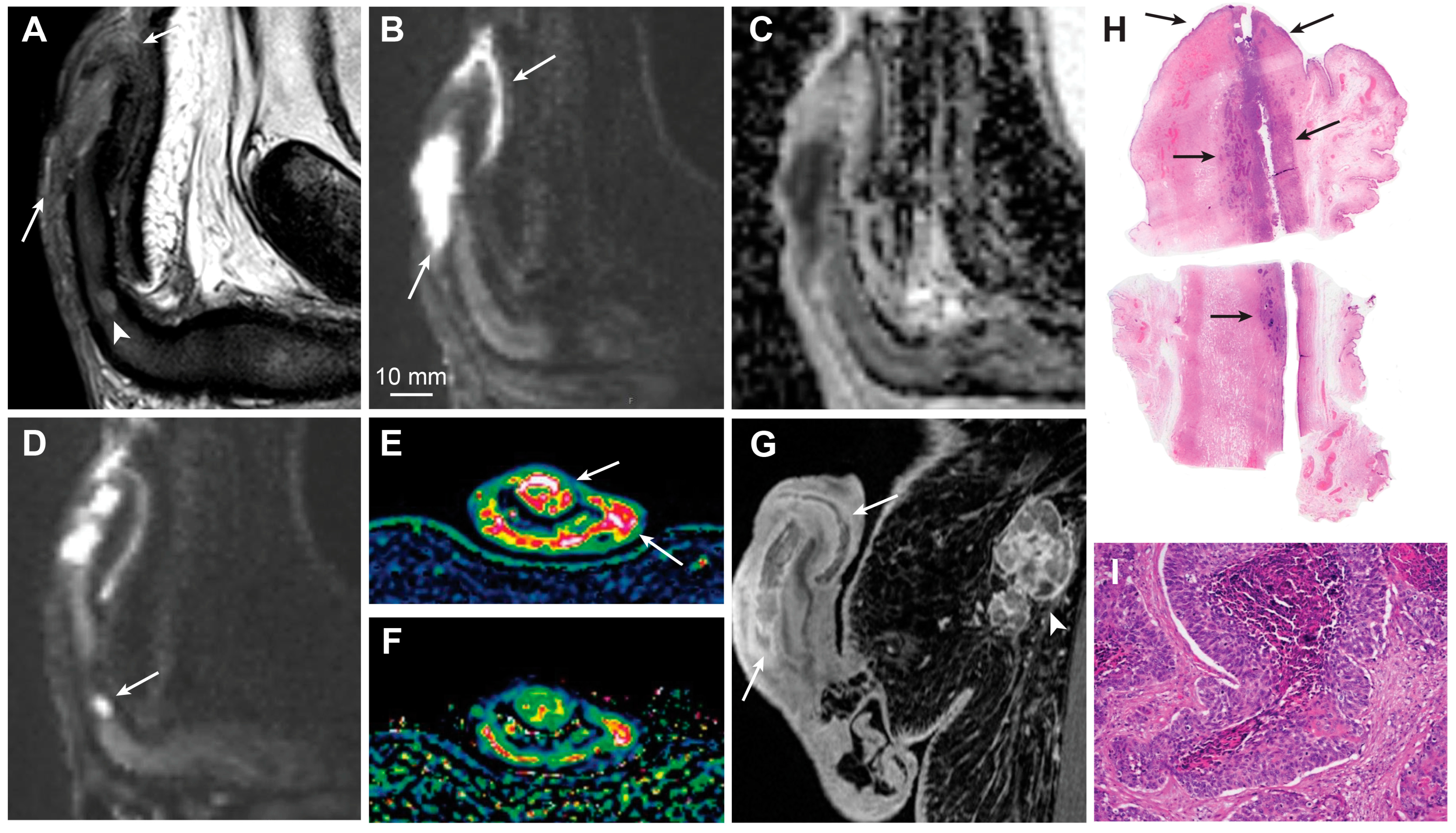 Cancers 15 05324 g004