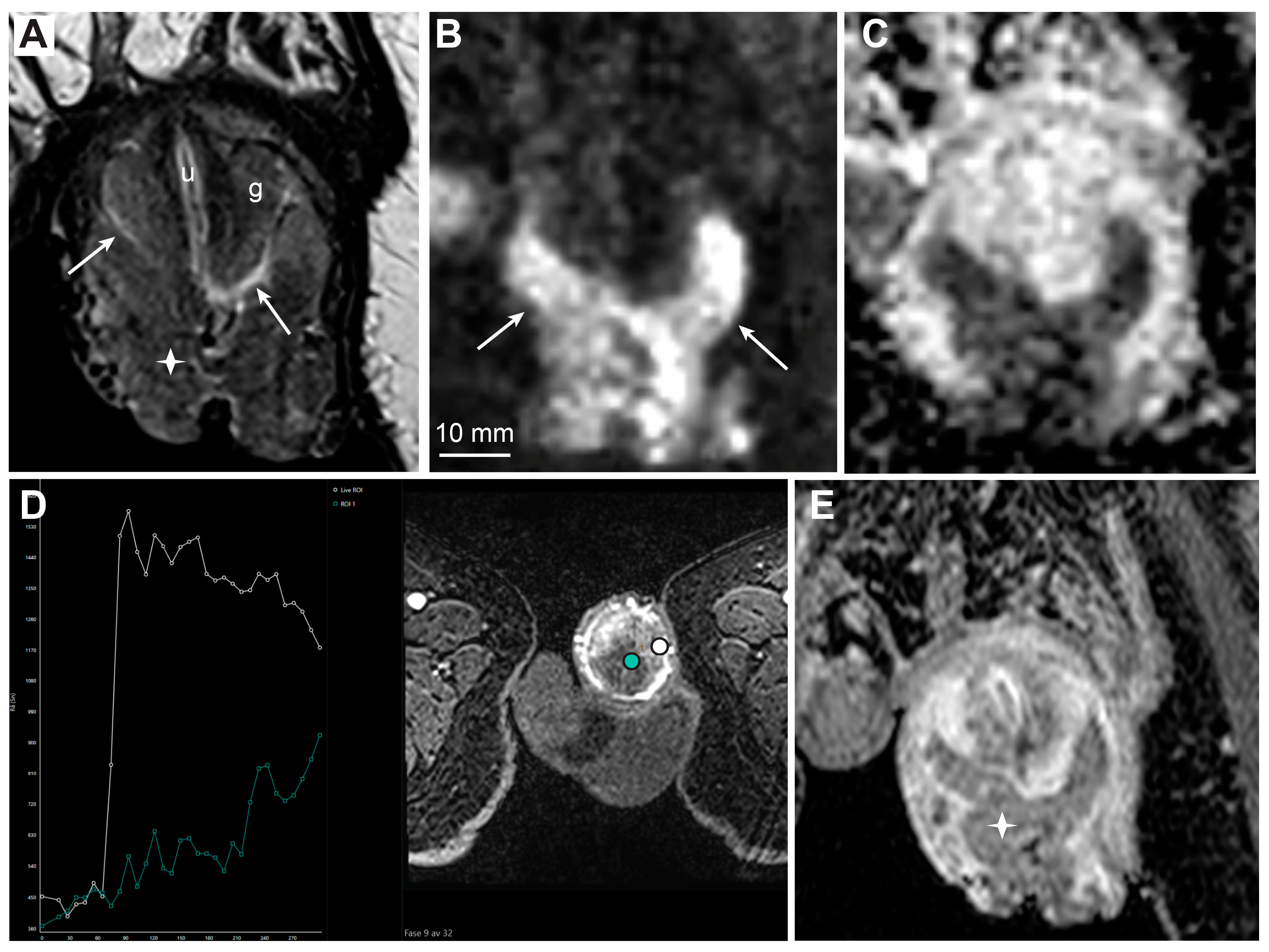 Cancers 15 05324 g005