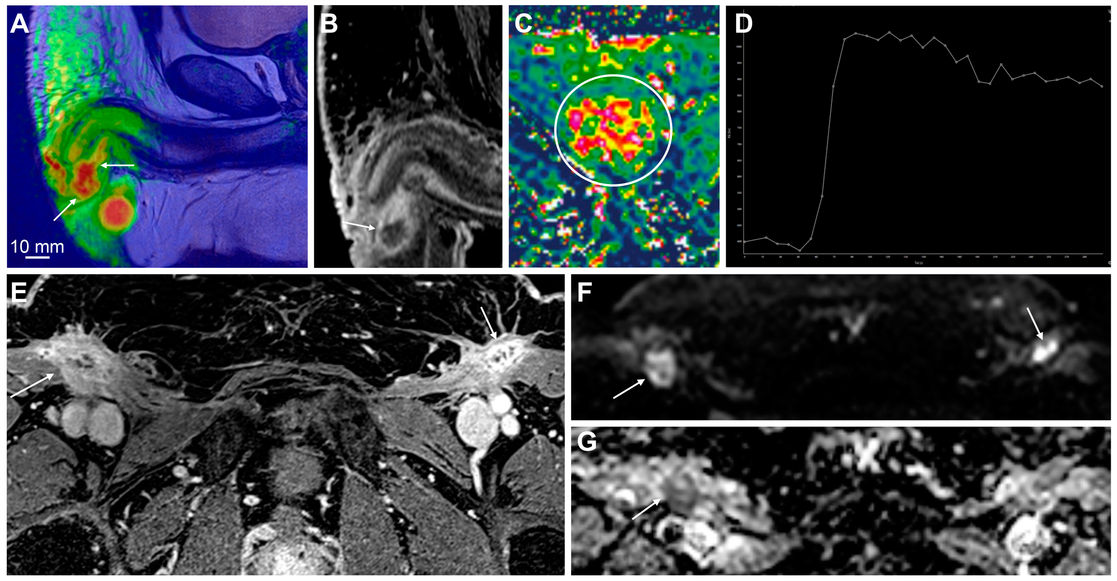 Cancers 15 05324 g006