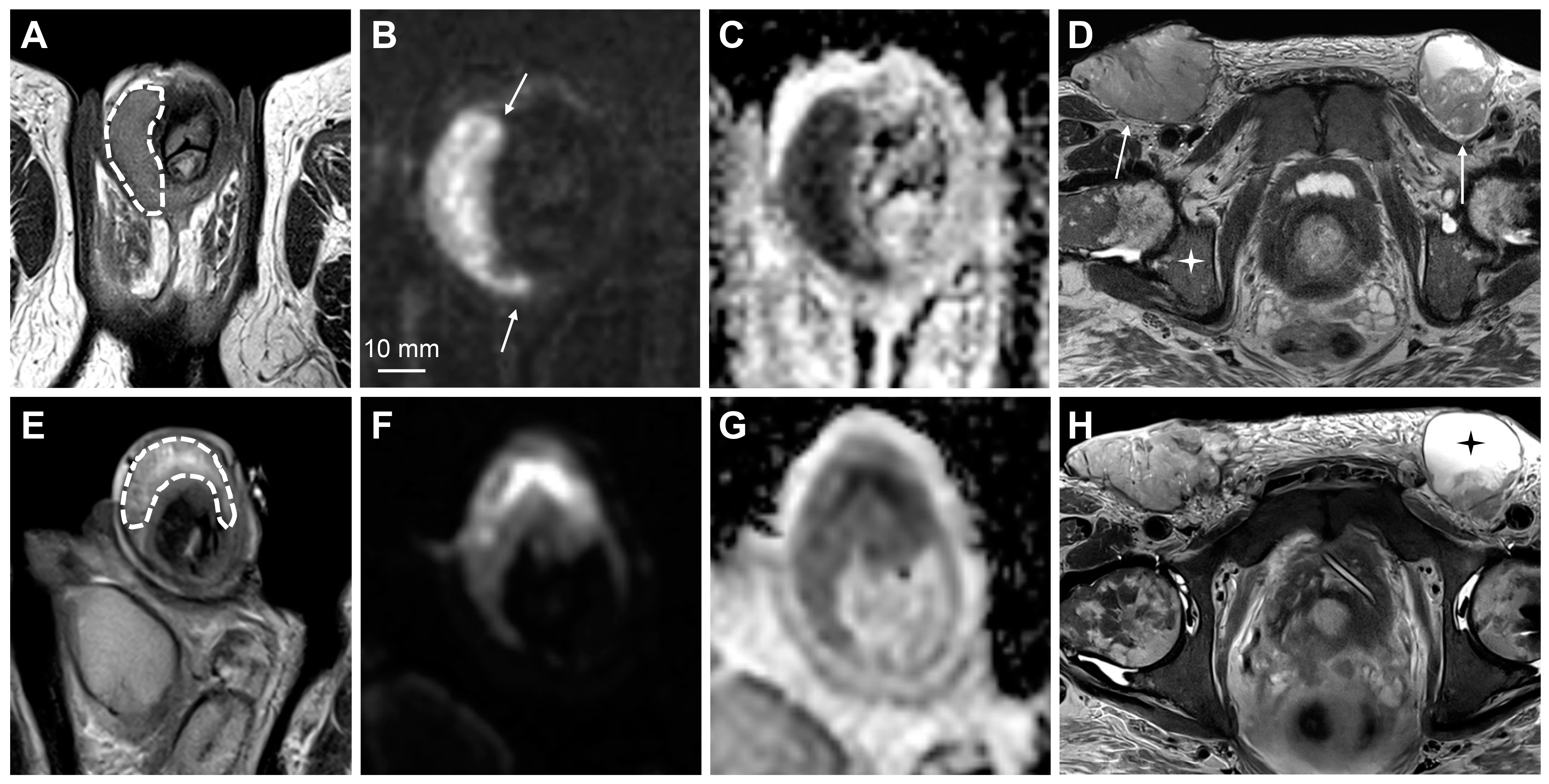 Cancers 15 05324 g007