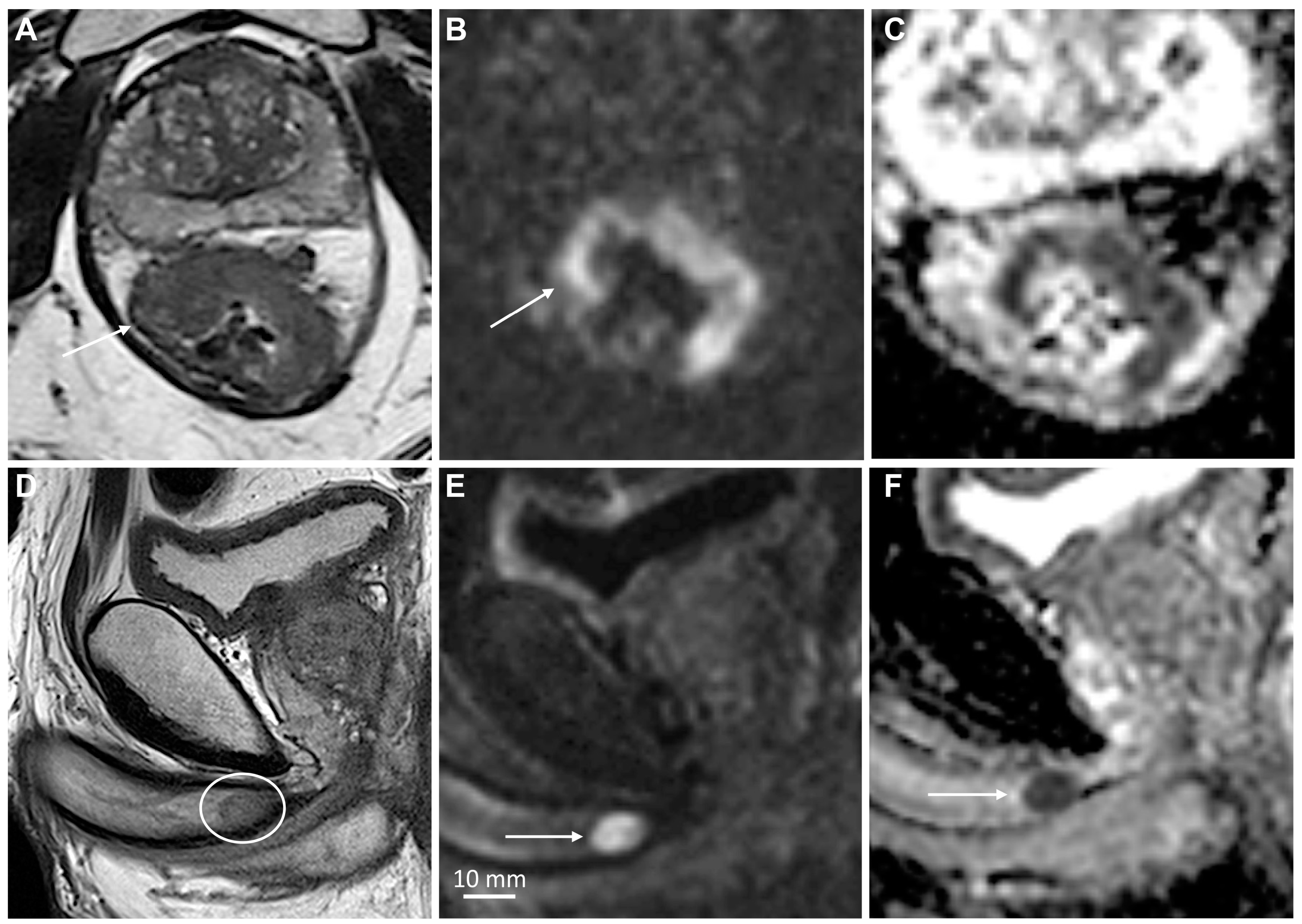 Cancers 15 05324 g009