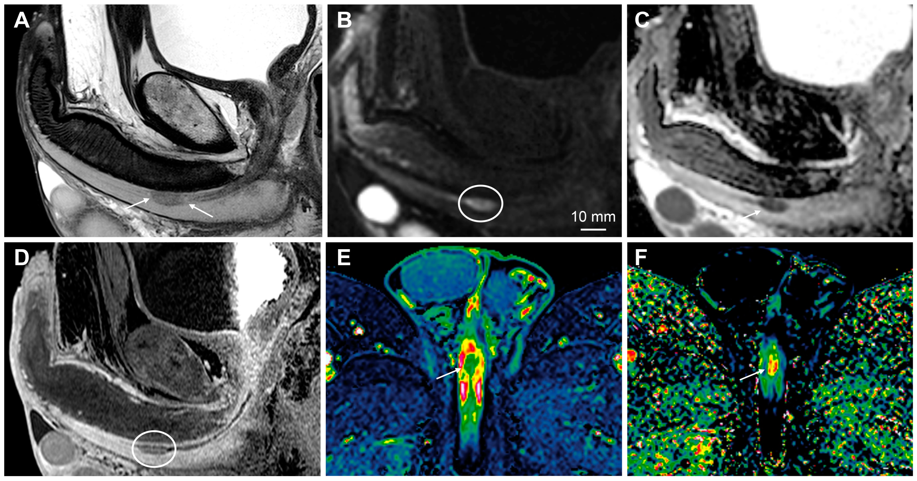 Cancers 15 05324 g010