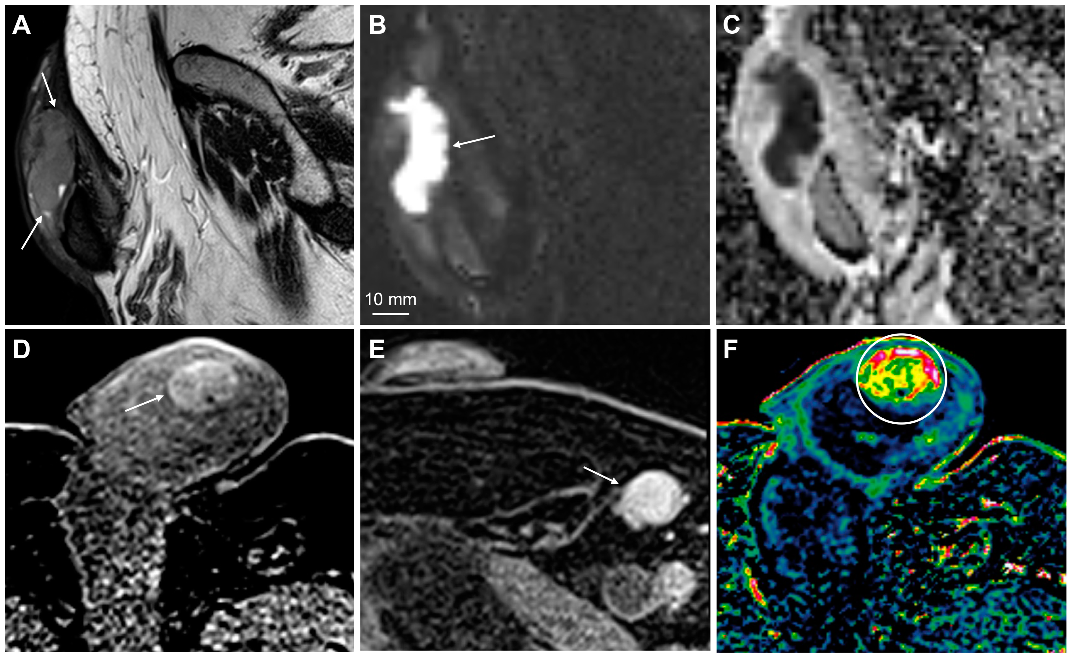 Cancers 15 05324 g011