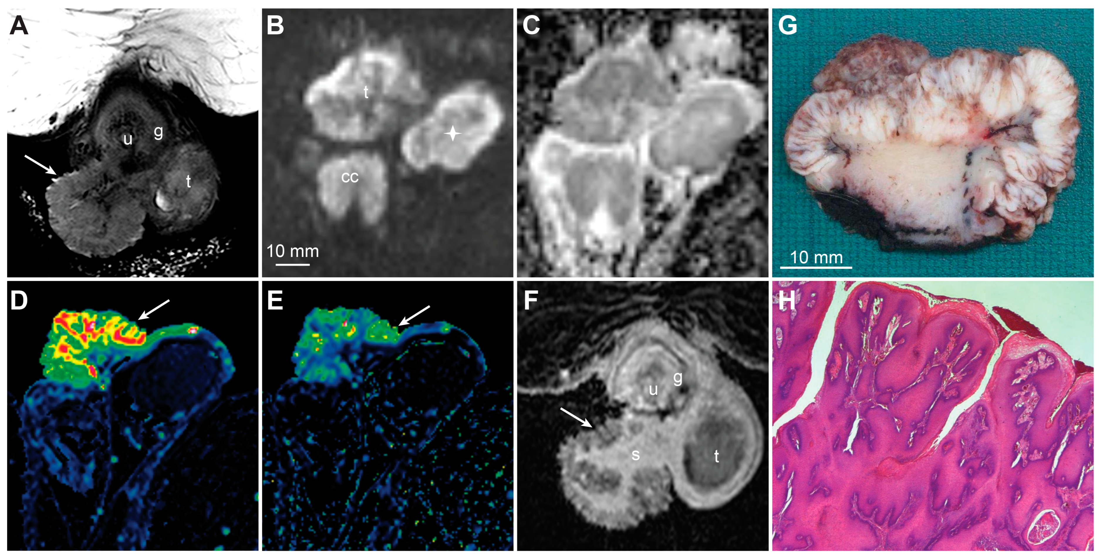 Cancers 15 05324 g012