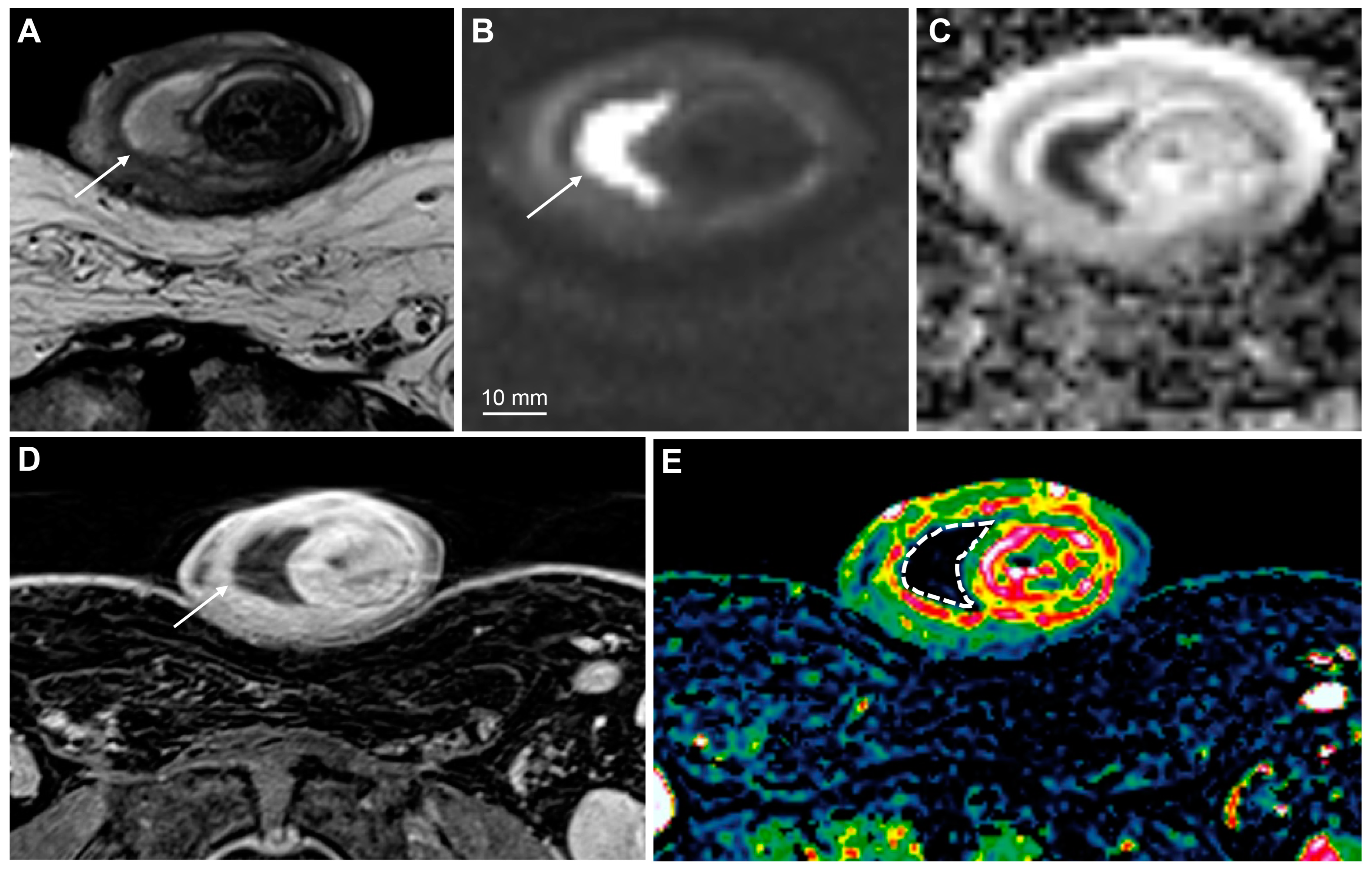 Cancers 15 05324 g013