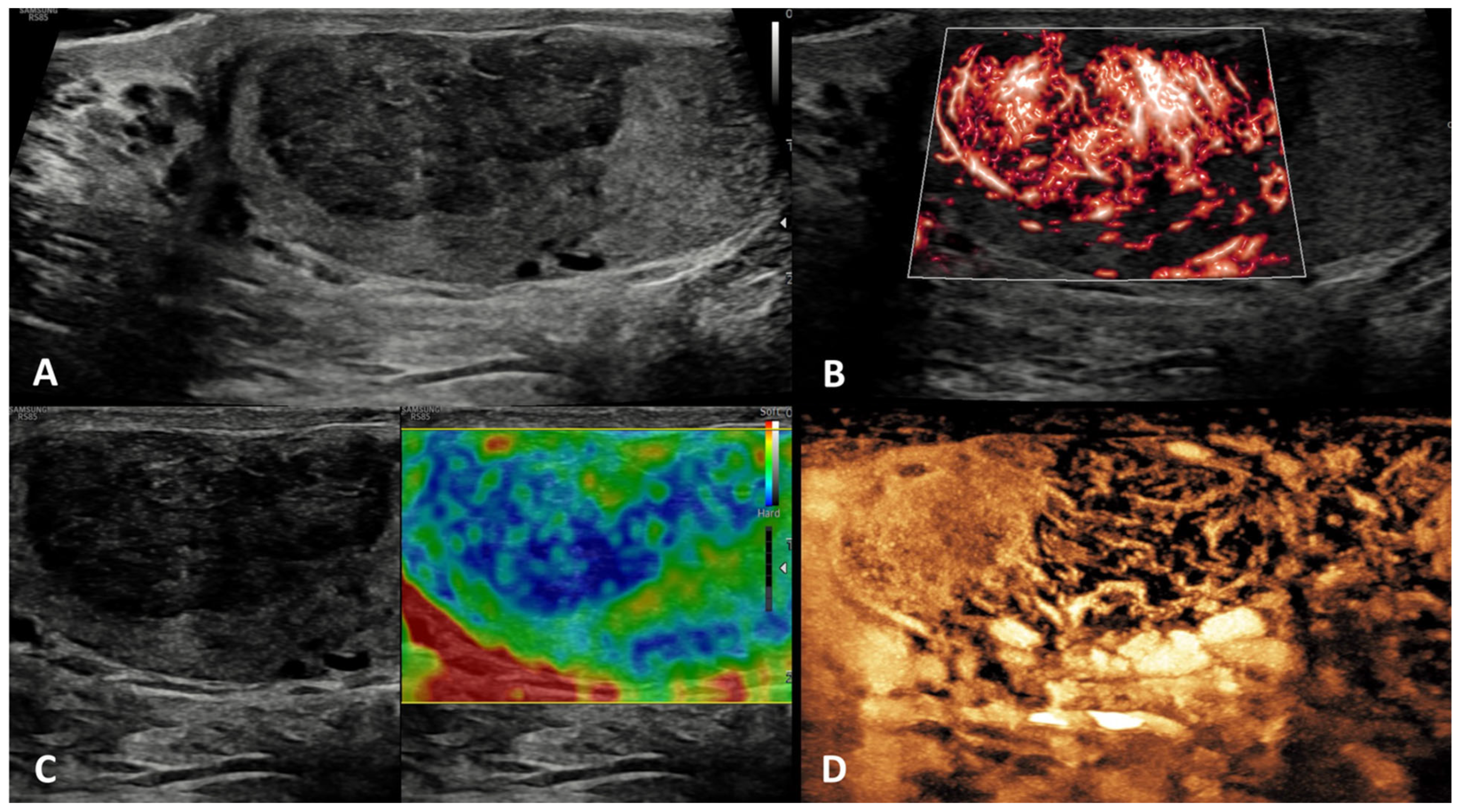 Cancers 15 05332 g003 Cancers 15 05332 g003