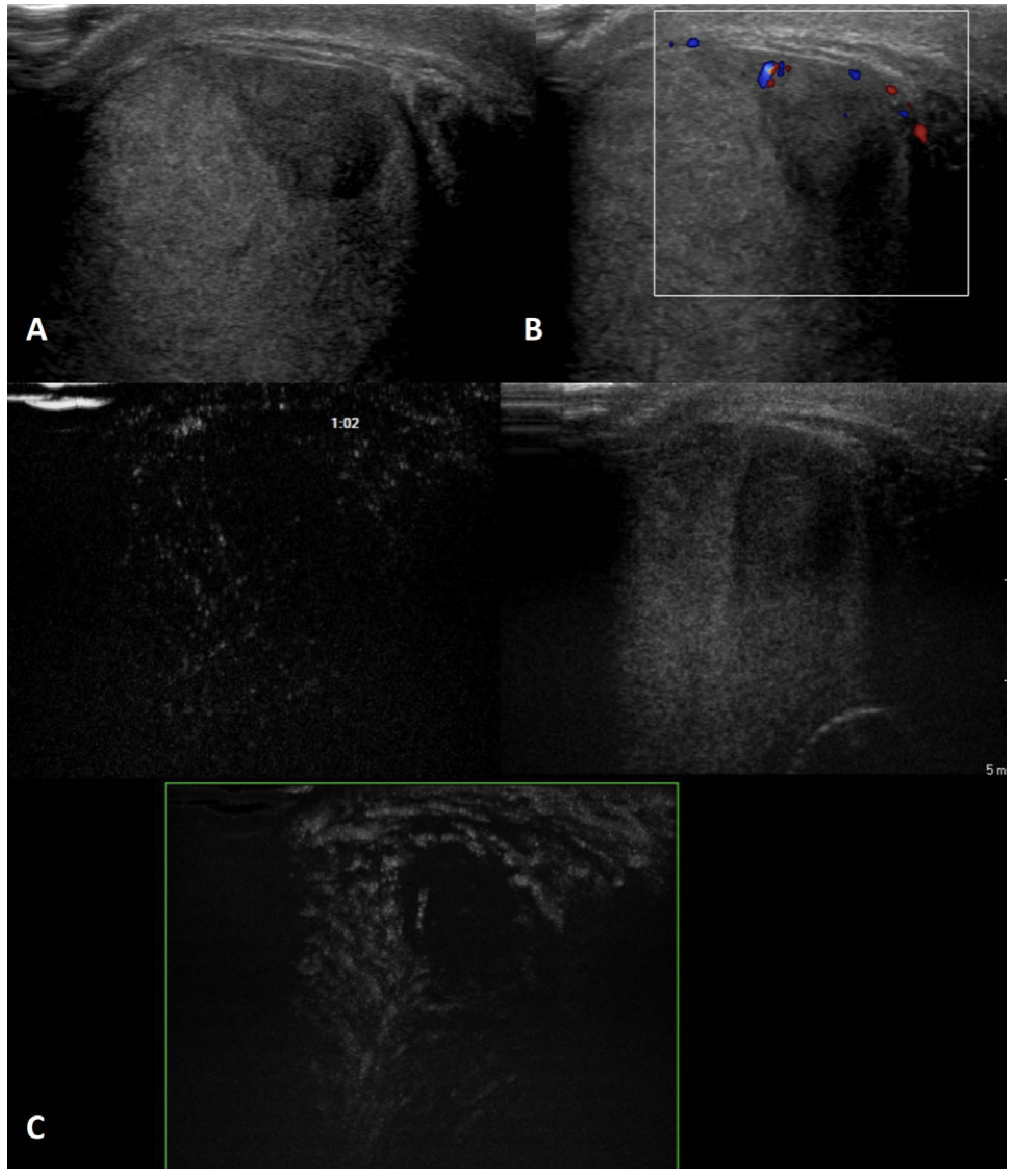 Cancers 15 05332 g005 Cancers 15 05332 g005