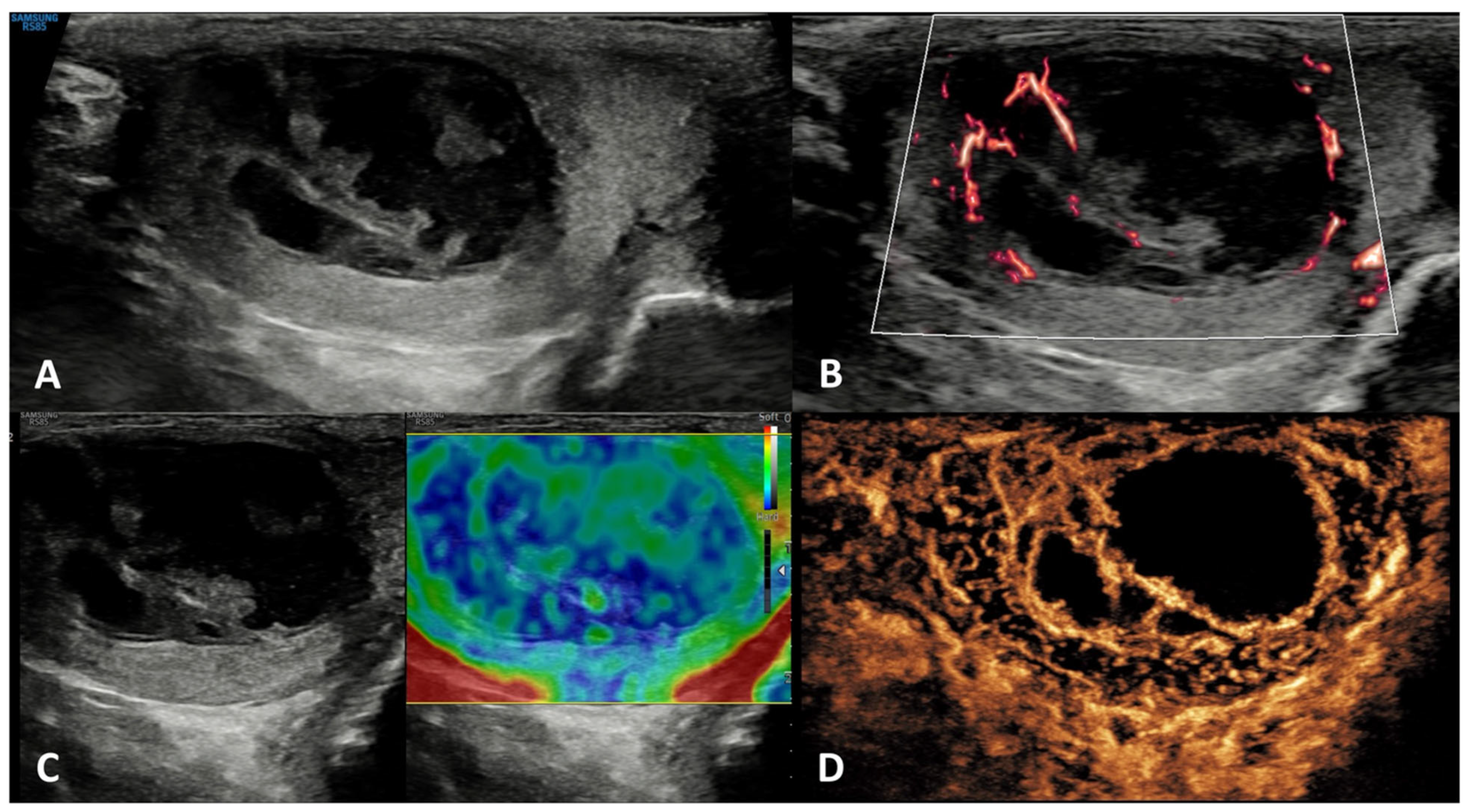 Cancers 15 05332 g006 Cancers 15 05332 g006