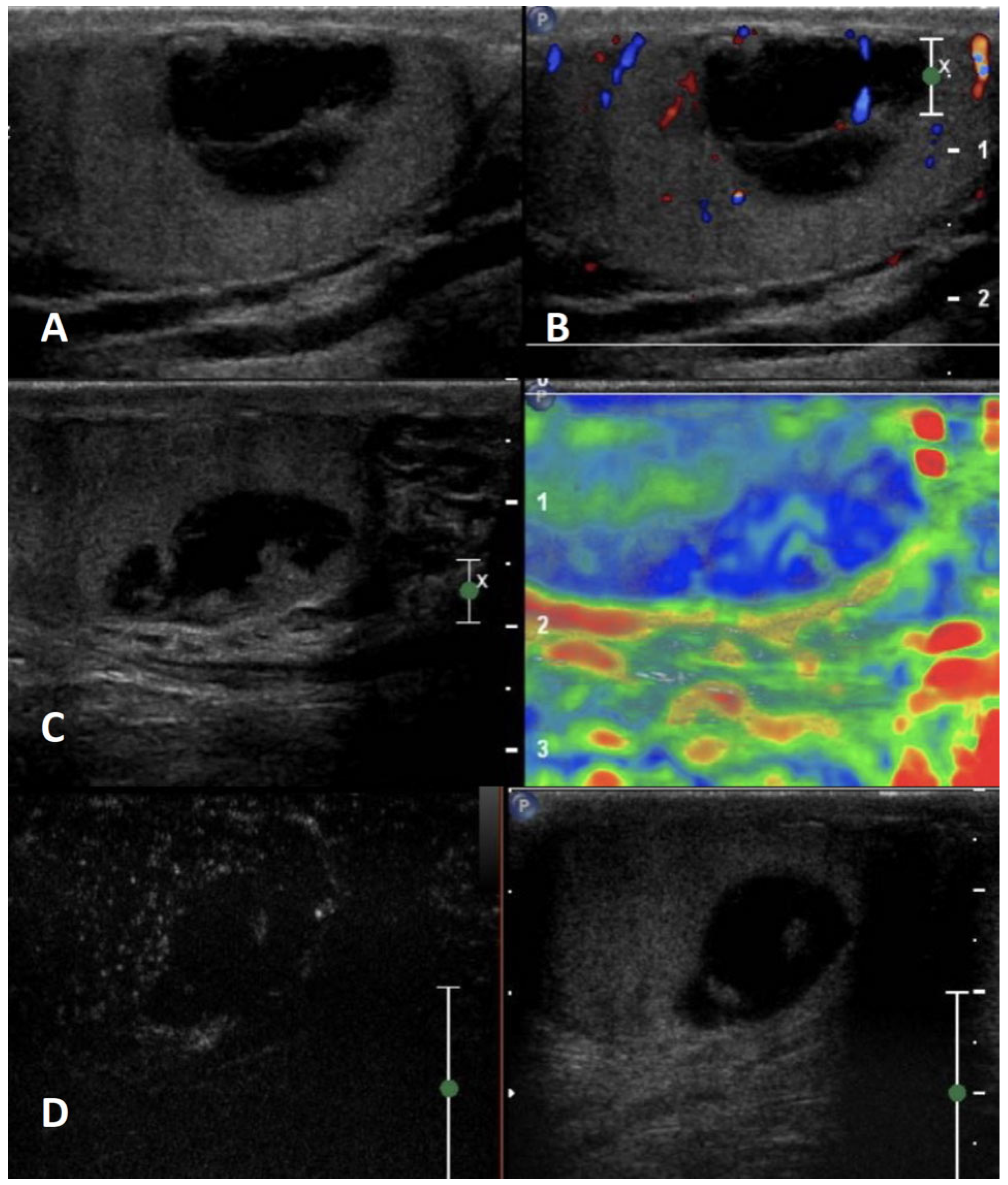 Cancers 15 05332 g007 Cancers 15 05332 g007