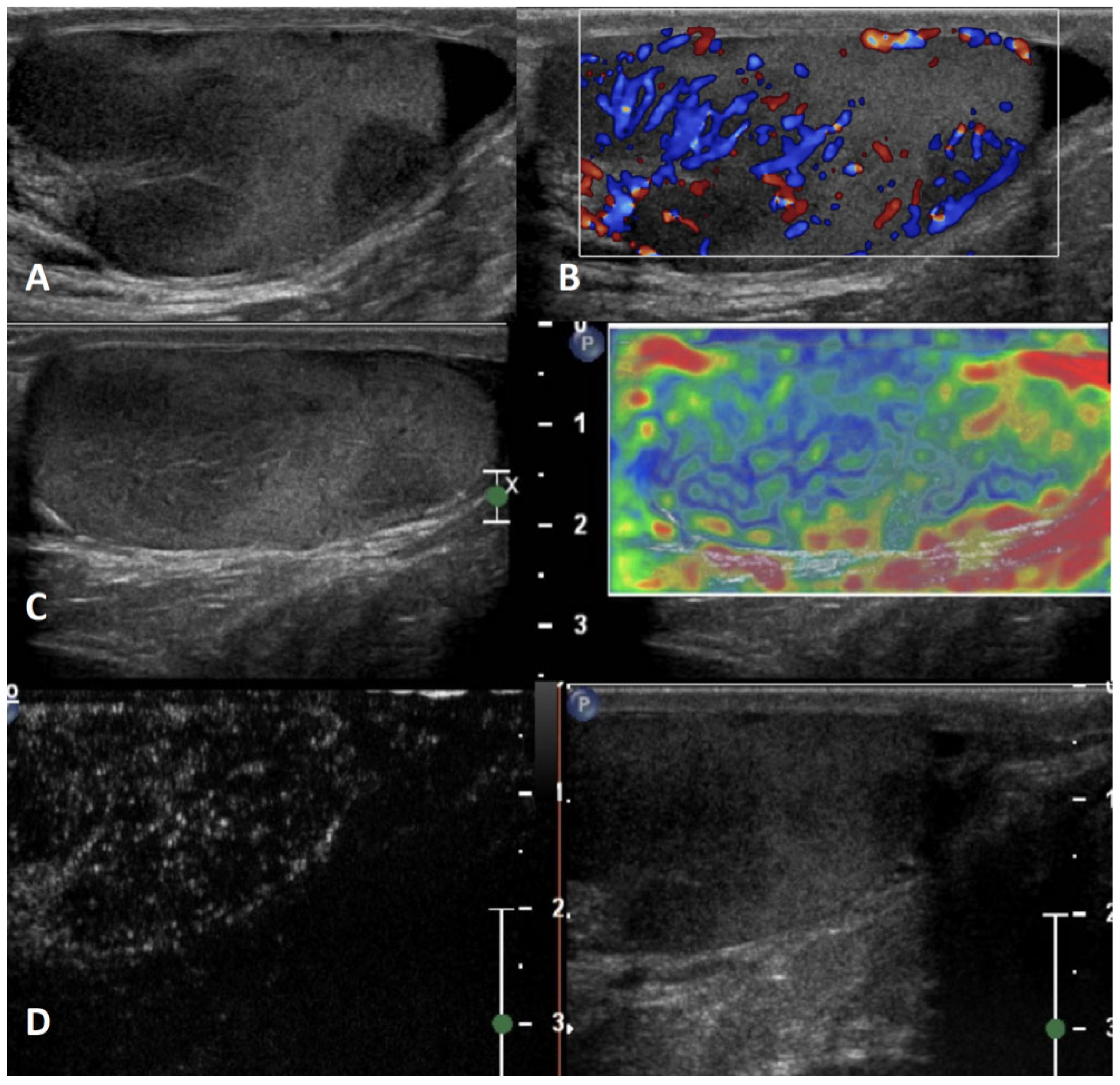Cancers 15 05332 g008 Cancers 15 05332 g008