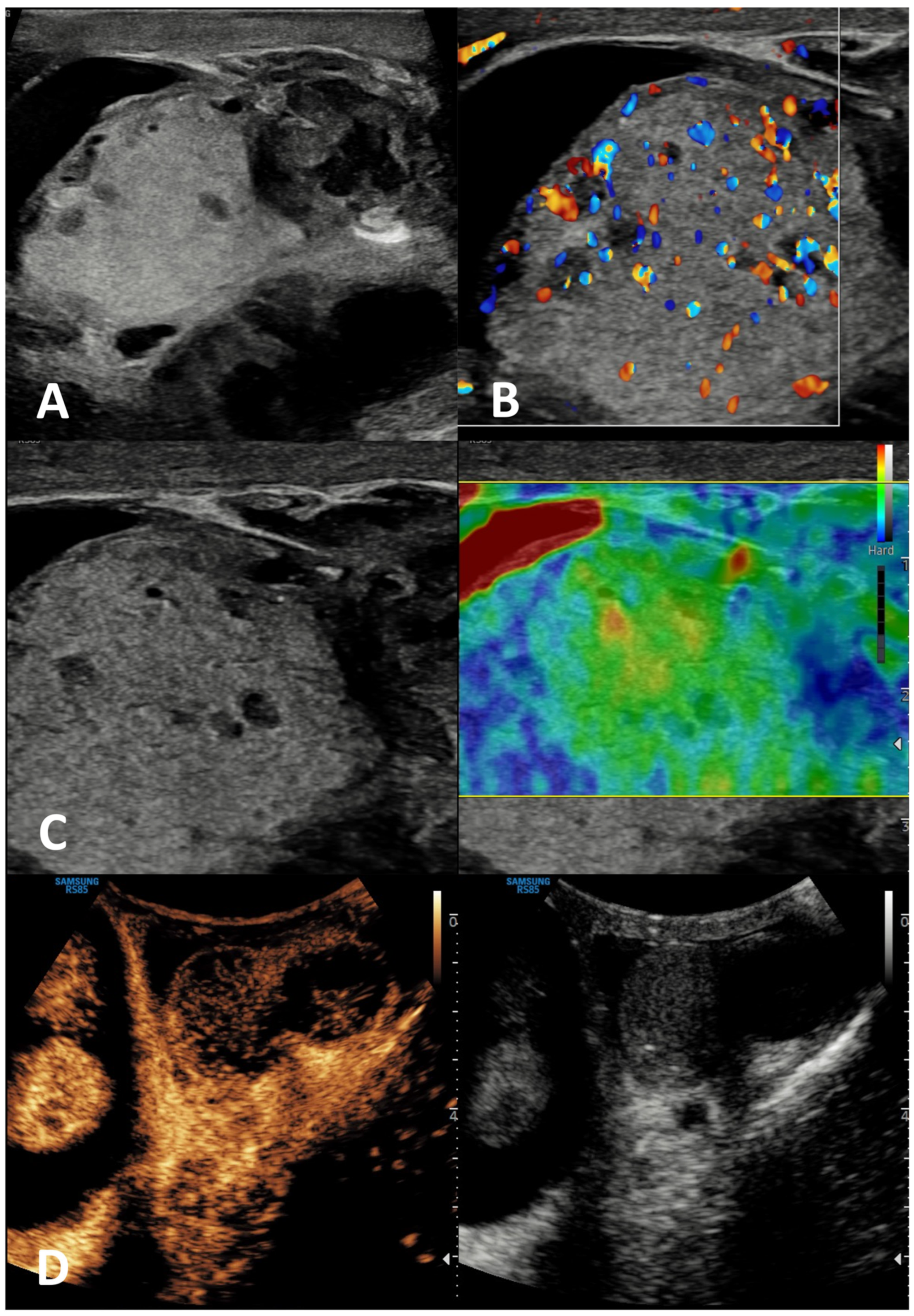 Cancers 15 05332 g009 Cancers 15 05332 g009