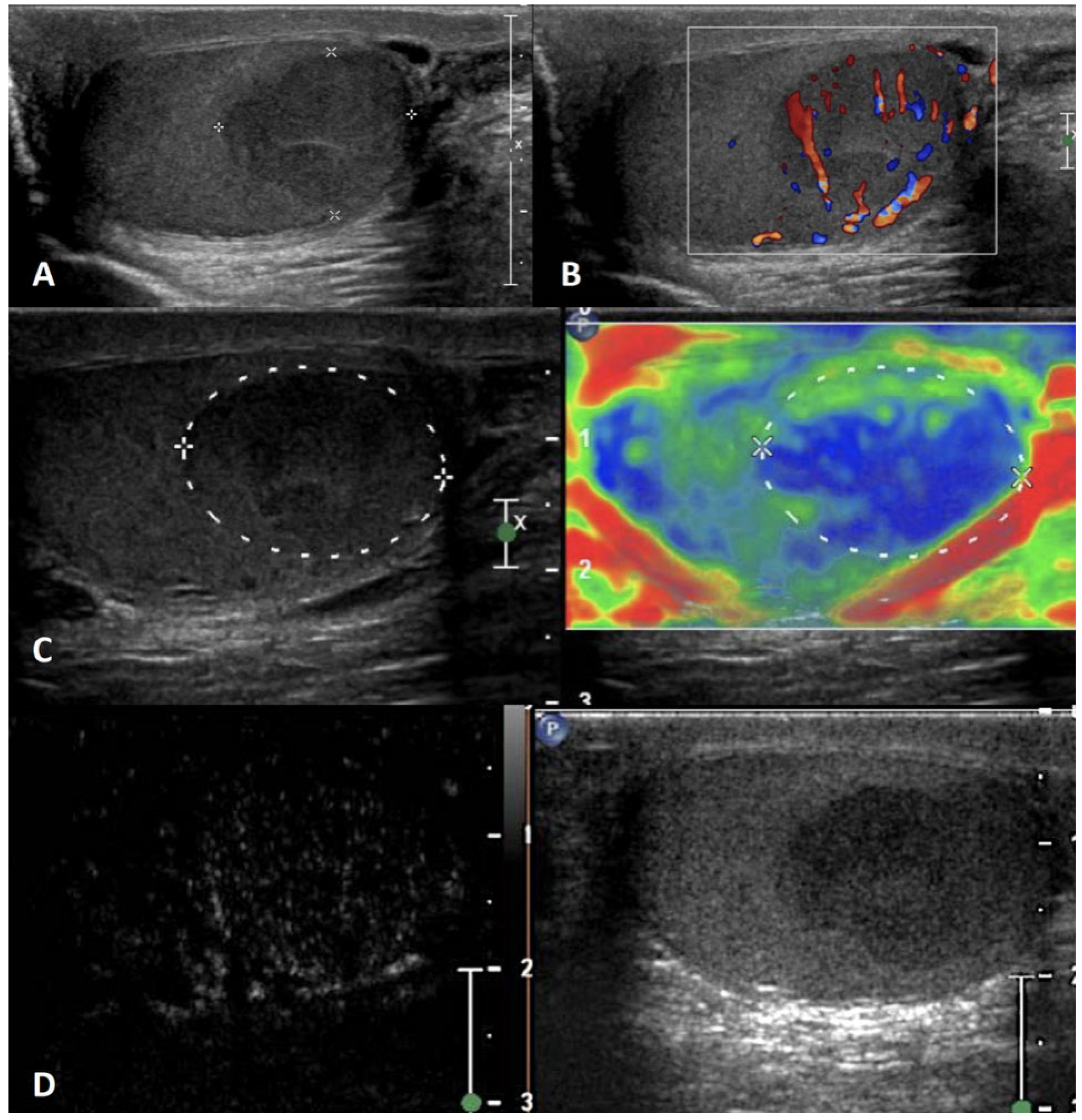 Cancers 15 05332 g010 Cancers 15 05332 g010