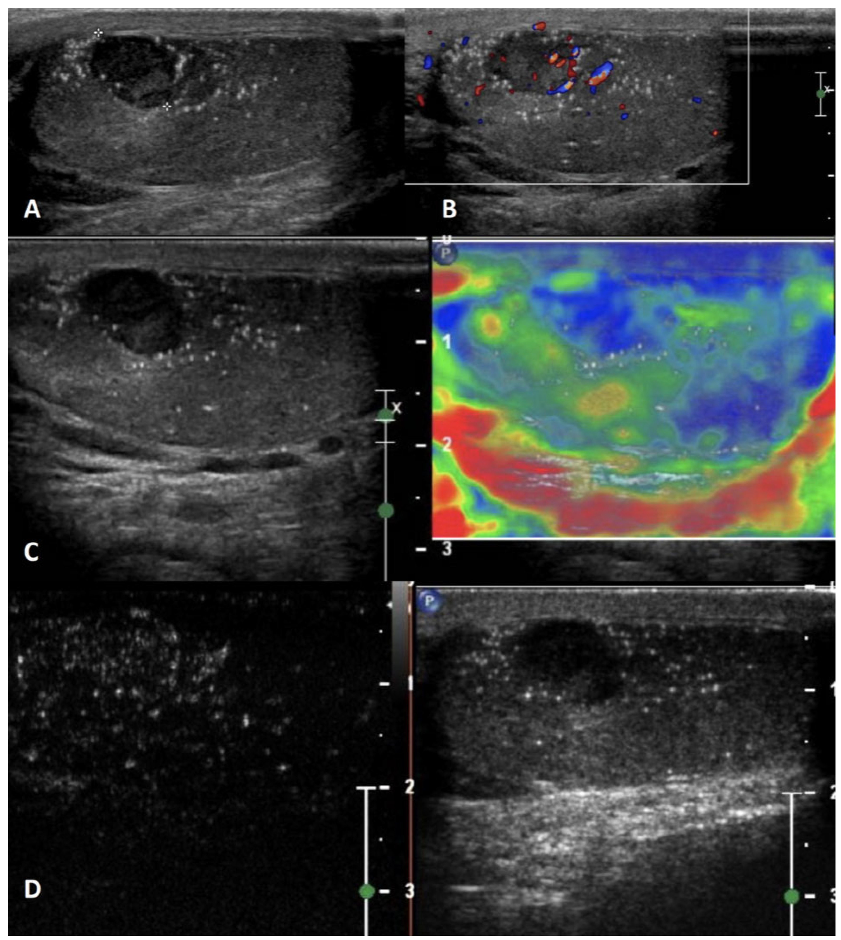Cancers 15 05332 g011 Cancers 15 05332 g011