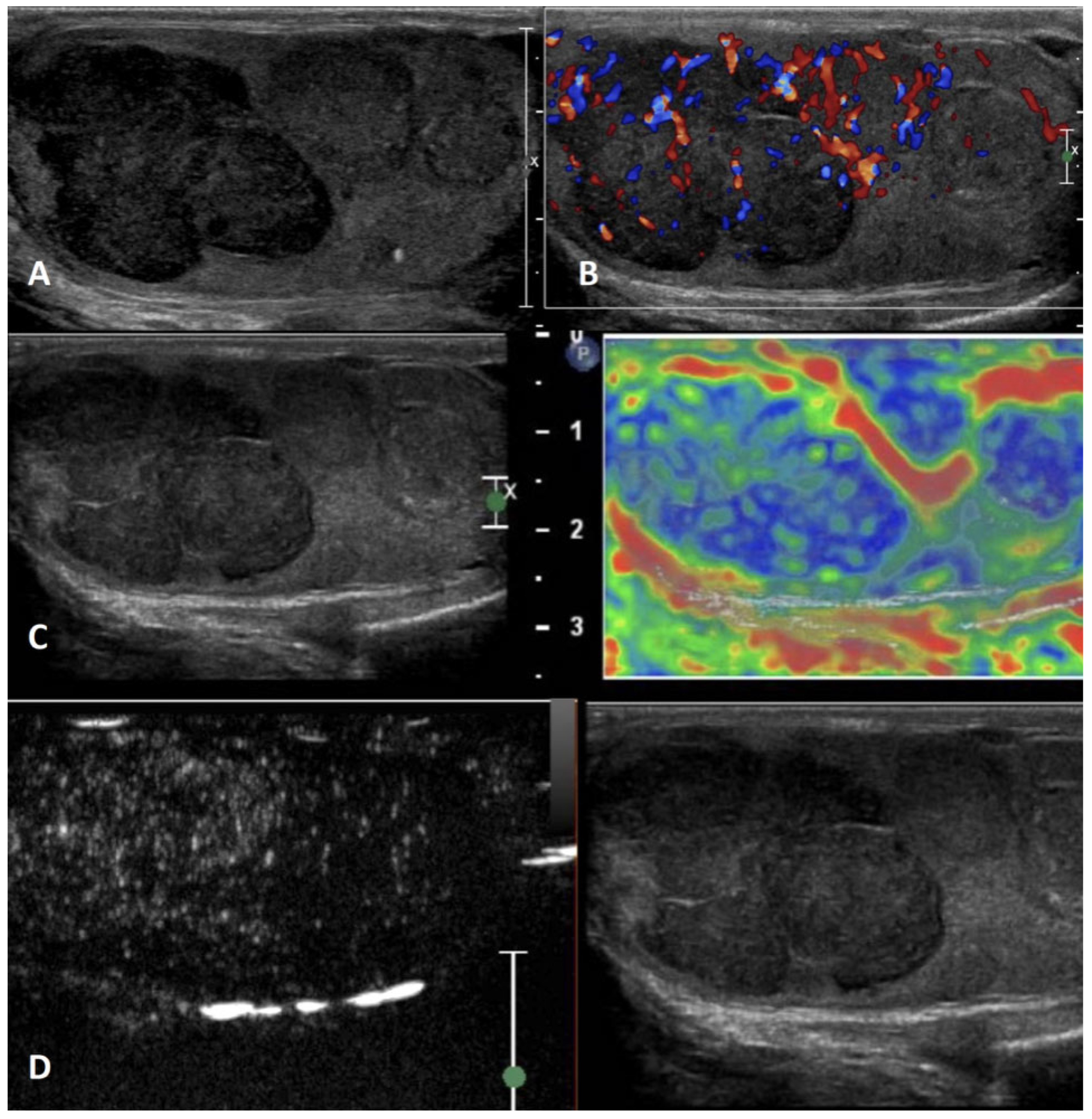 Cancers 15 05332 g012 Cancers 15 05332 g012