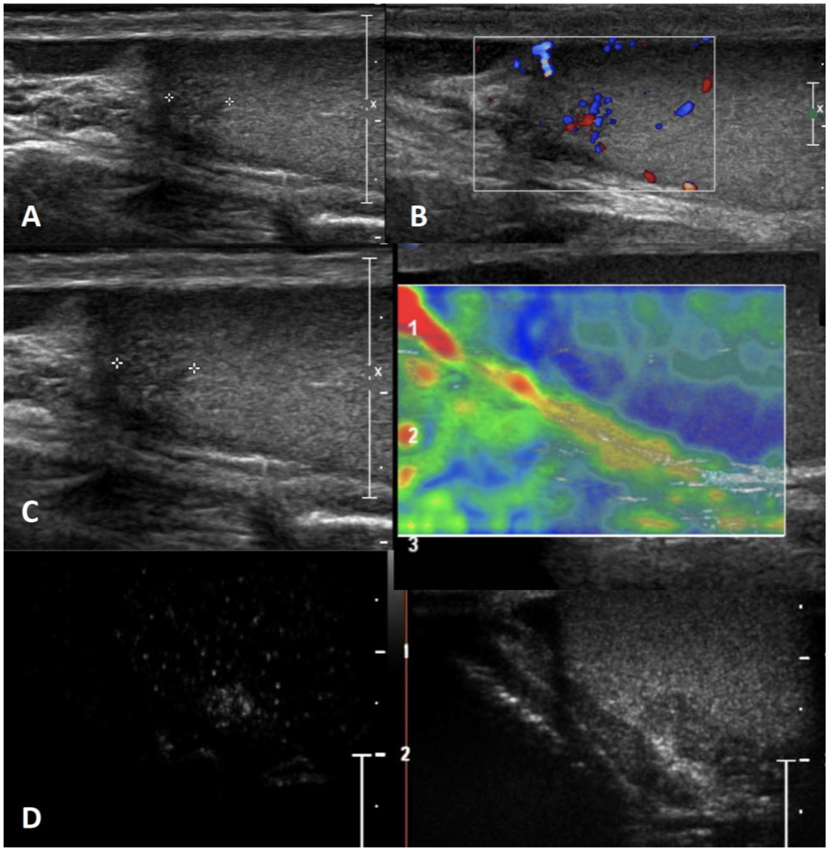 Cancers 15 05332 g014 Cancers 15 05332 g014