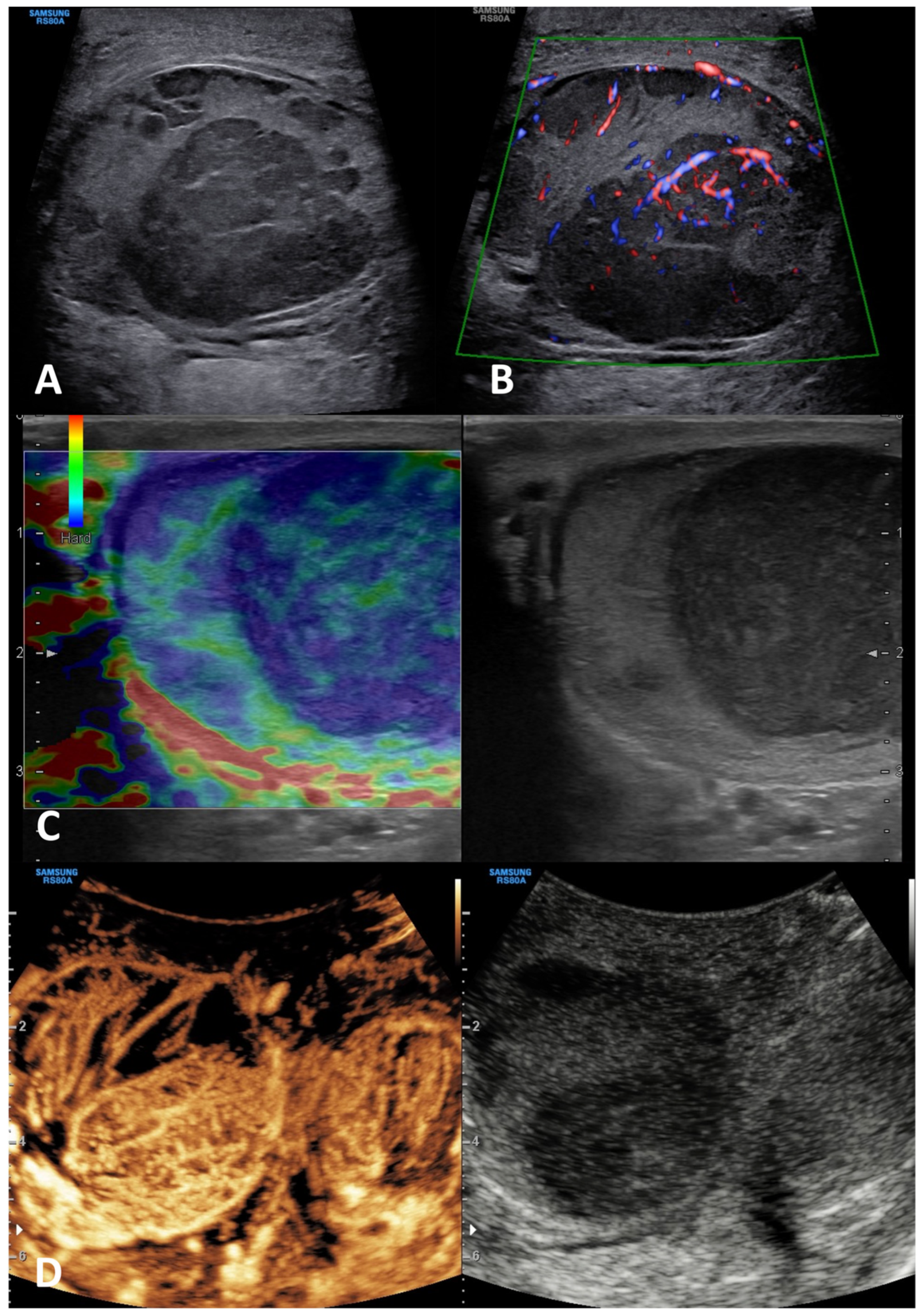 Cancers 15 05332 g015 Cancers 15 05332 g015