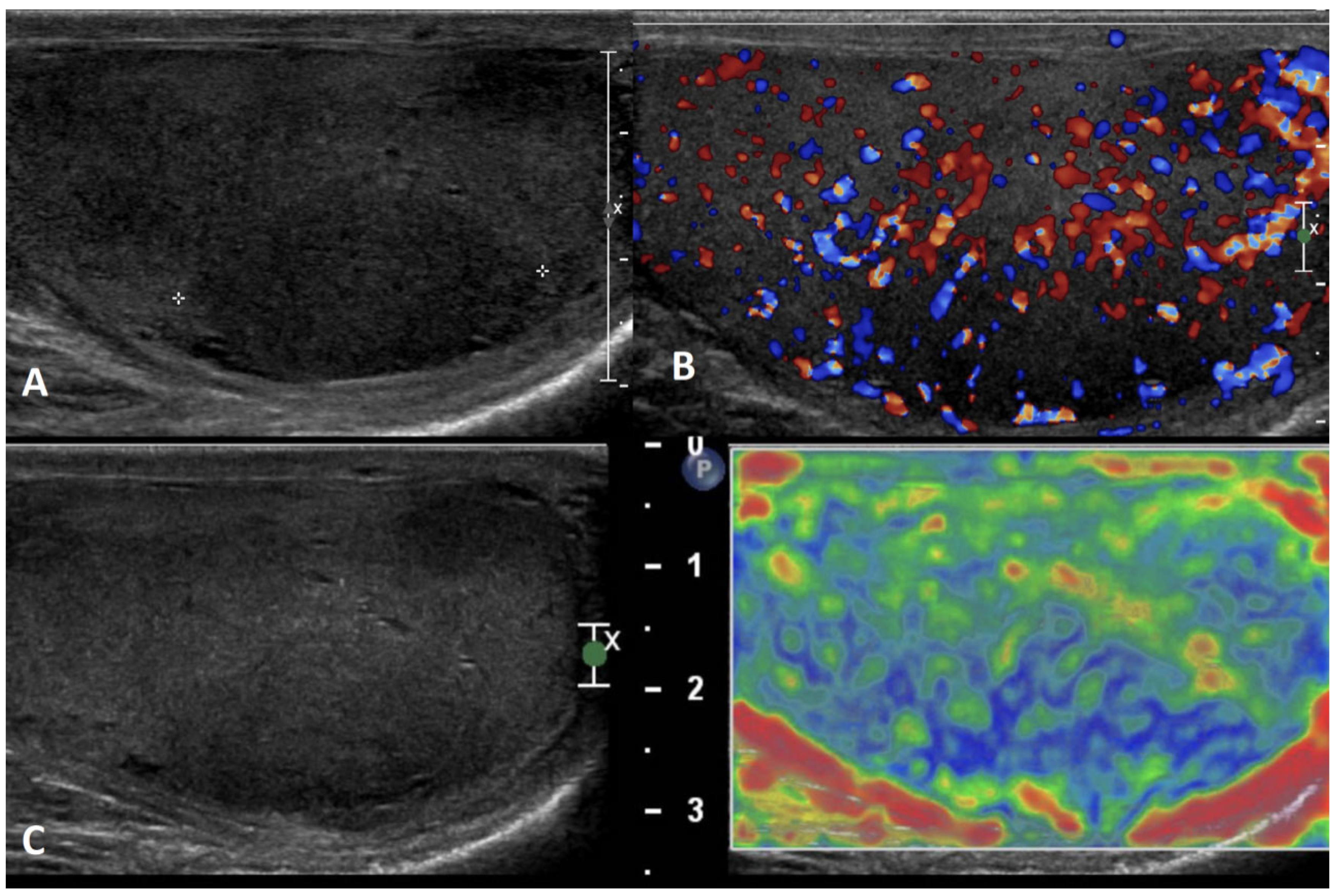 Cancers 15 05332 g017 Cancers 15 05332 g017