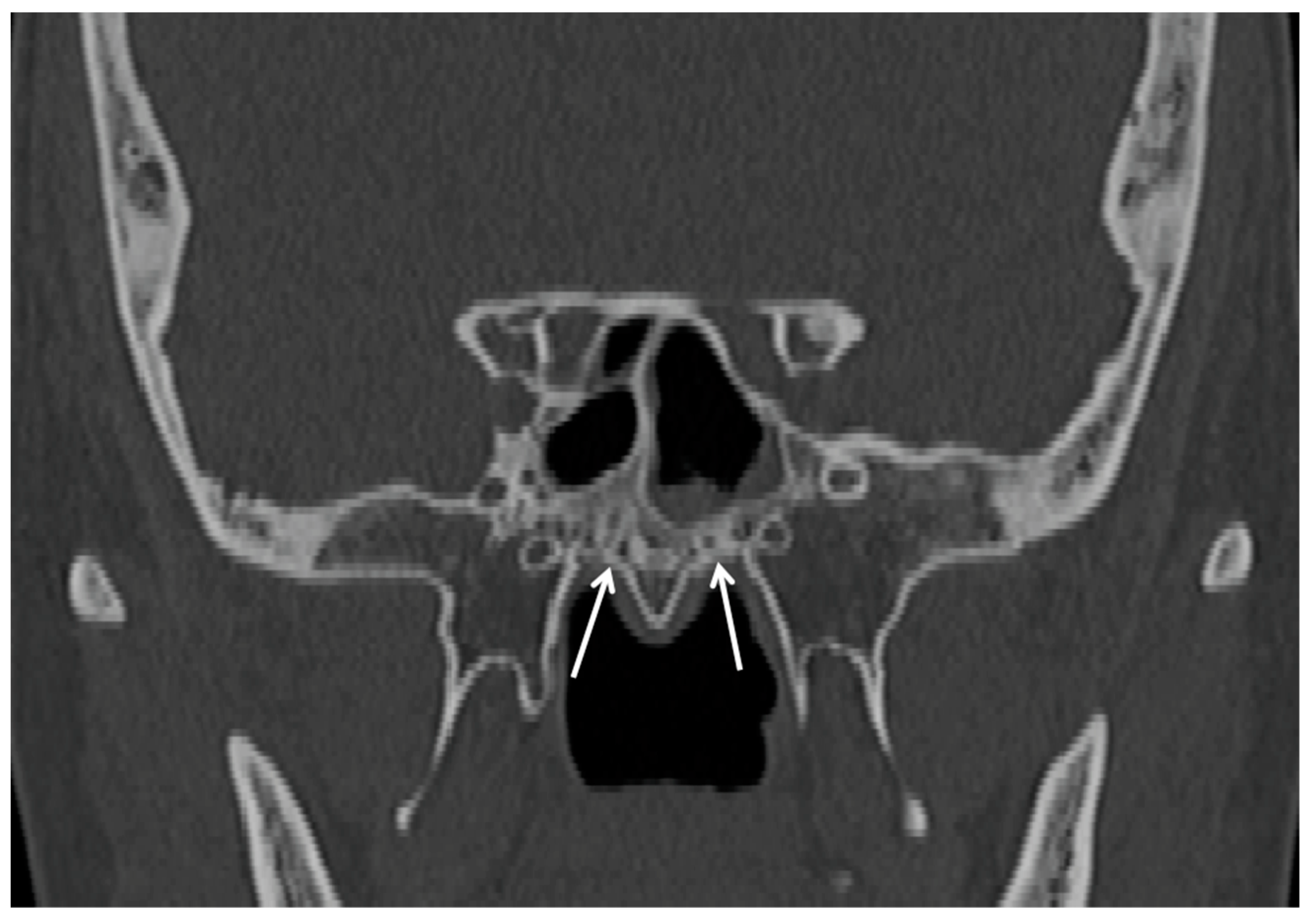 Cancers 15 05341 g004