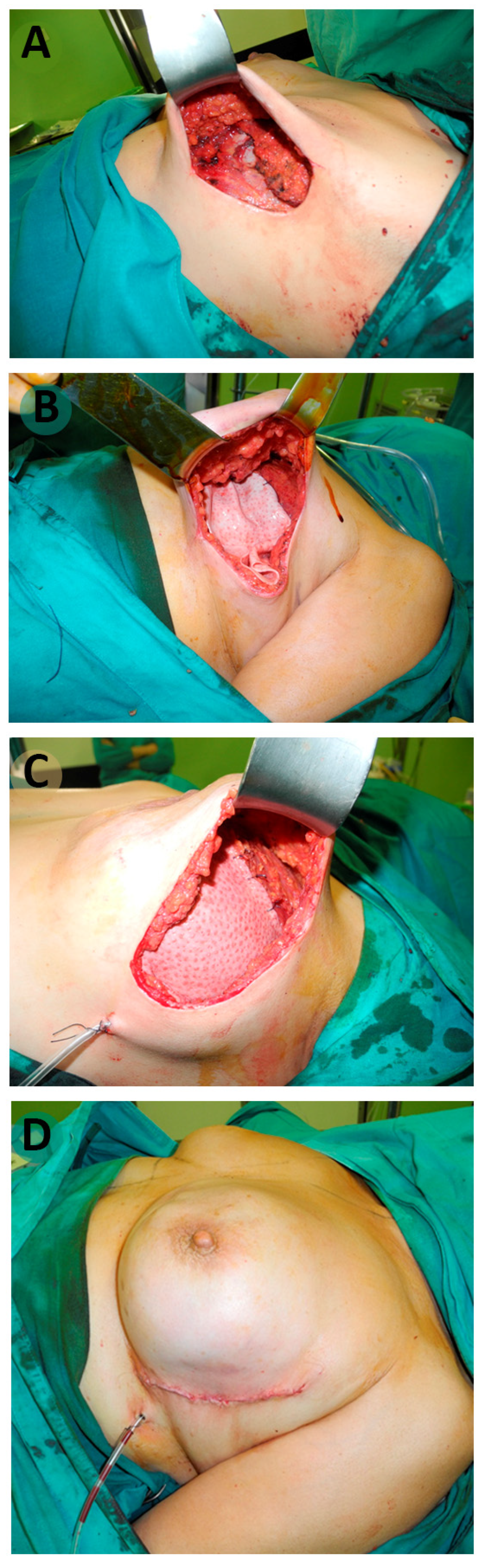 Cancers 15 05349 g001