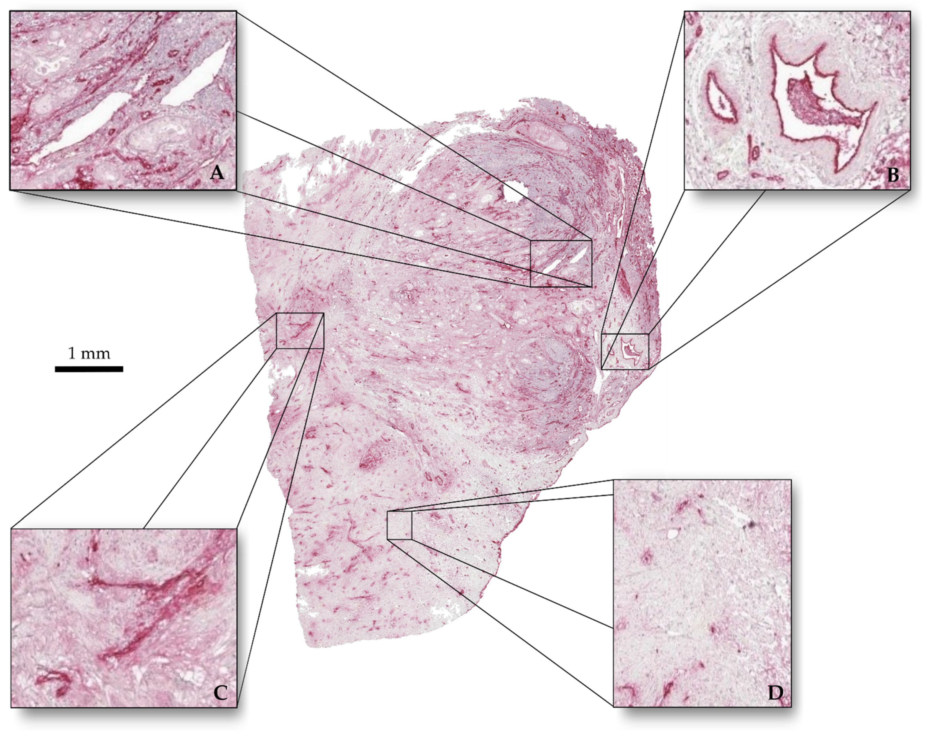 Cancers 15 05352 g002 Cancers 15 05352 g002