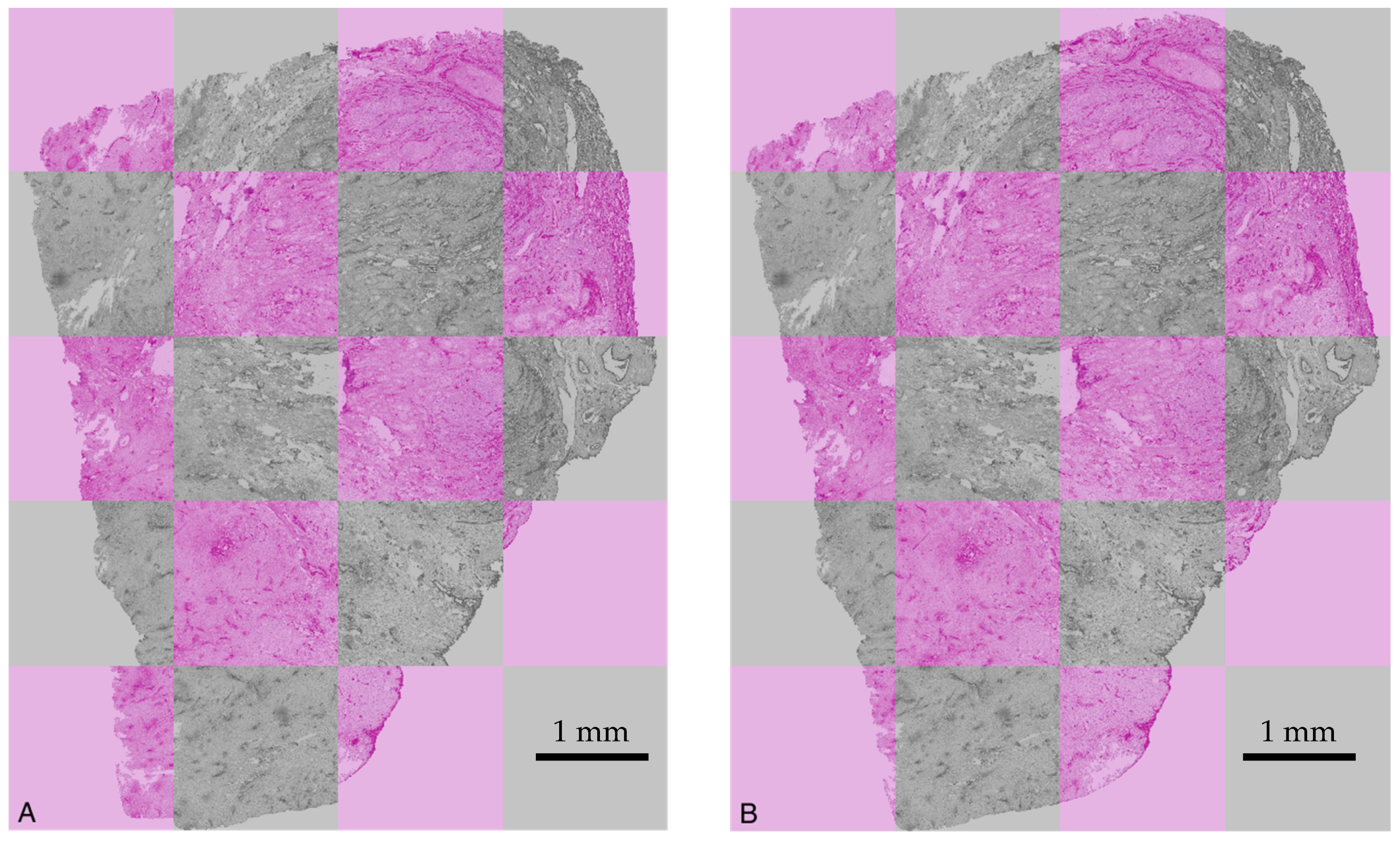 Cancers 15 05352 g006 Cancers 15 05352 g006